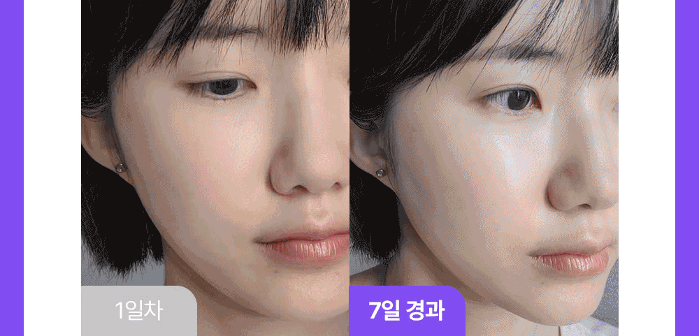 1+1|DERMAFIRM 💜 R4 藍甘菊外泌體水光精華