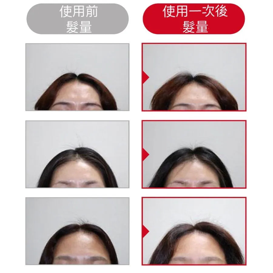 Dr. FORHAIR💗 防脫去頭皮洗頭水