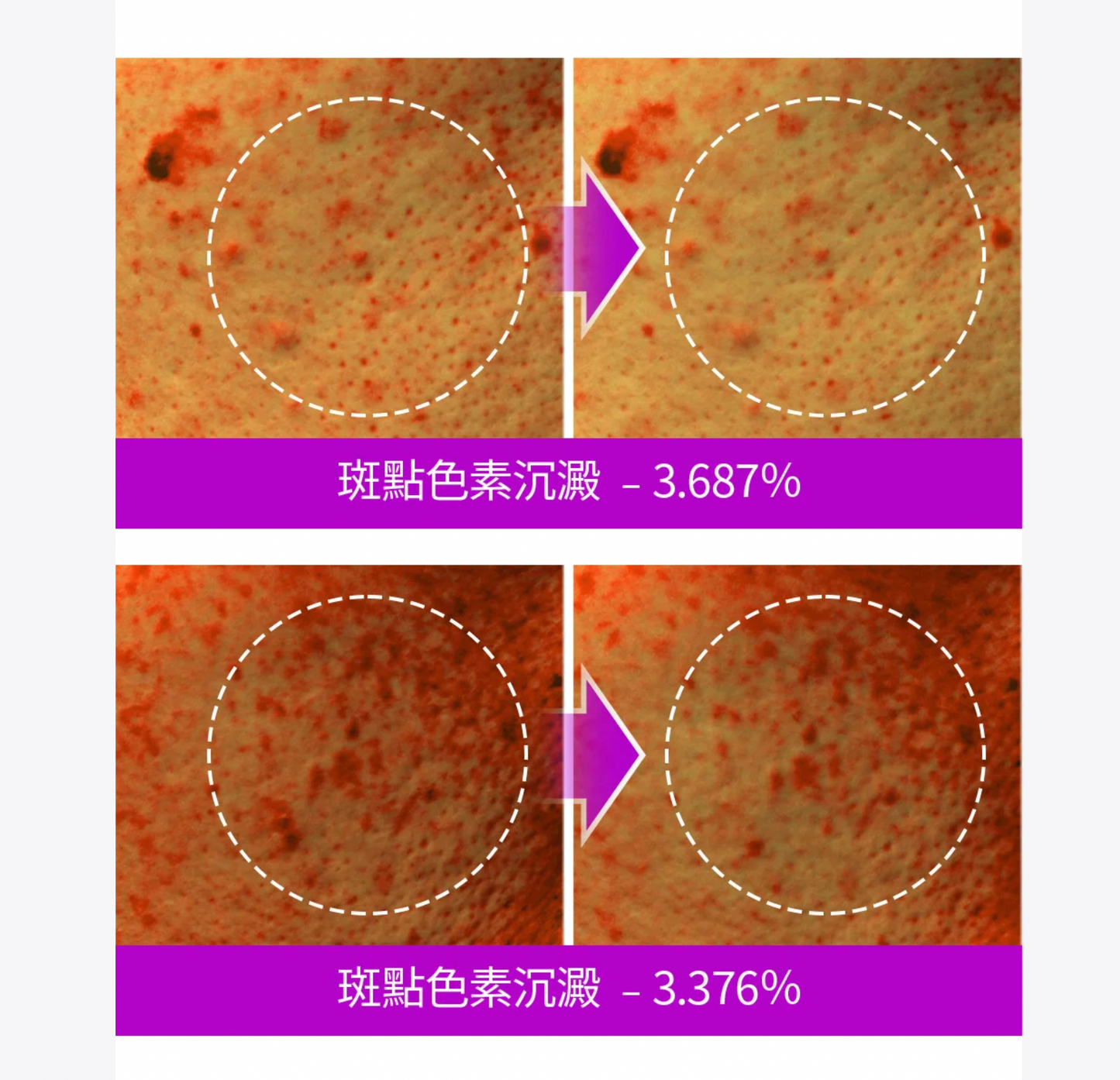 SUNGBOON EDITOR 🍇山葡萄維他命C亮白去斑棉片