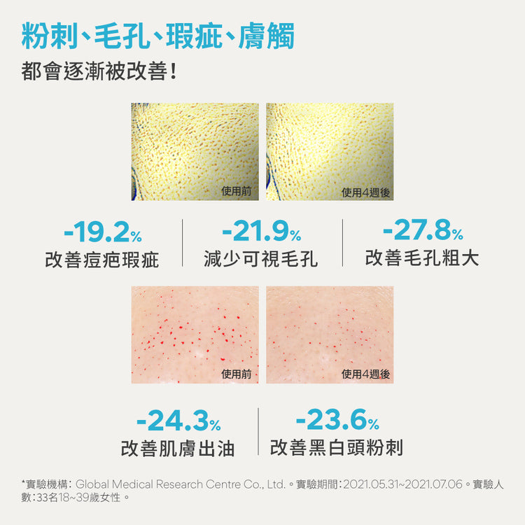 30ml+30ml| innisfree 💙A醇淨膚超修護安瓶