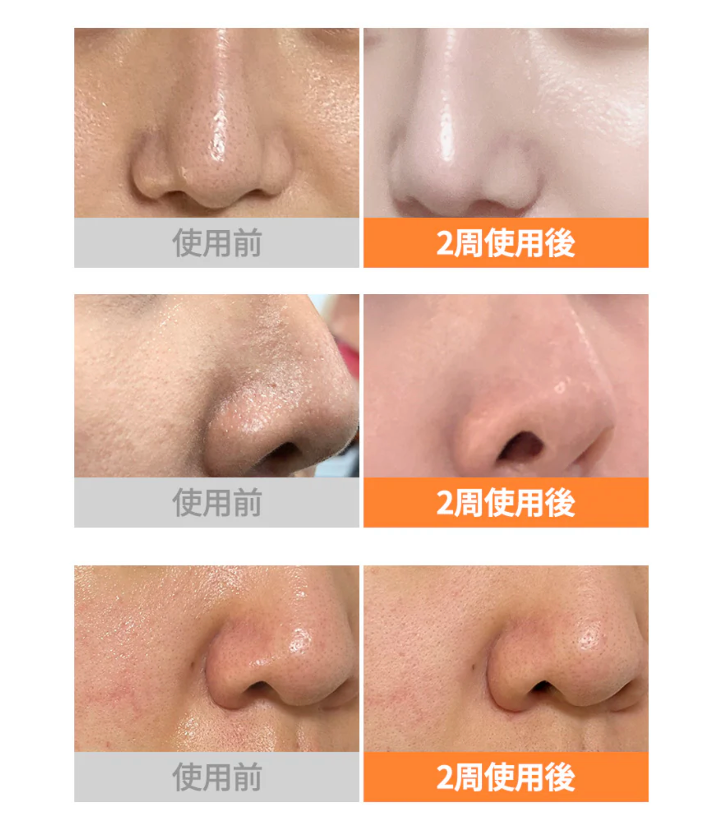 milktouch 🍊濟州柑橘神仙精華液