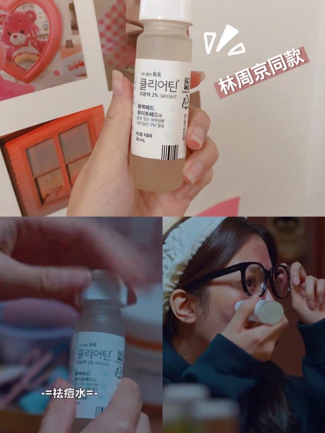 最新版本|HANDOK 💗 Clearteen 韓國國民去暗瘡去痘精華水