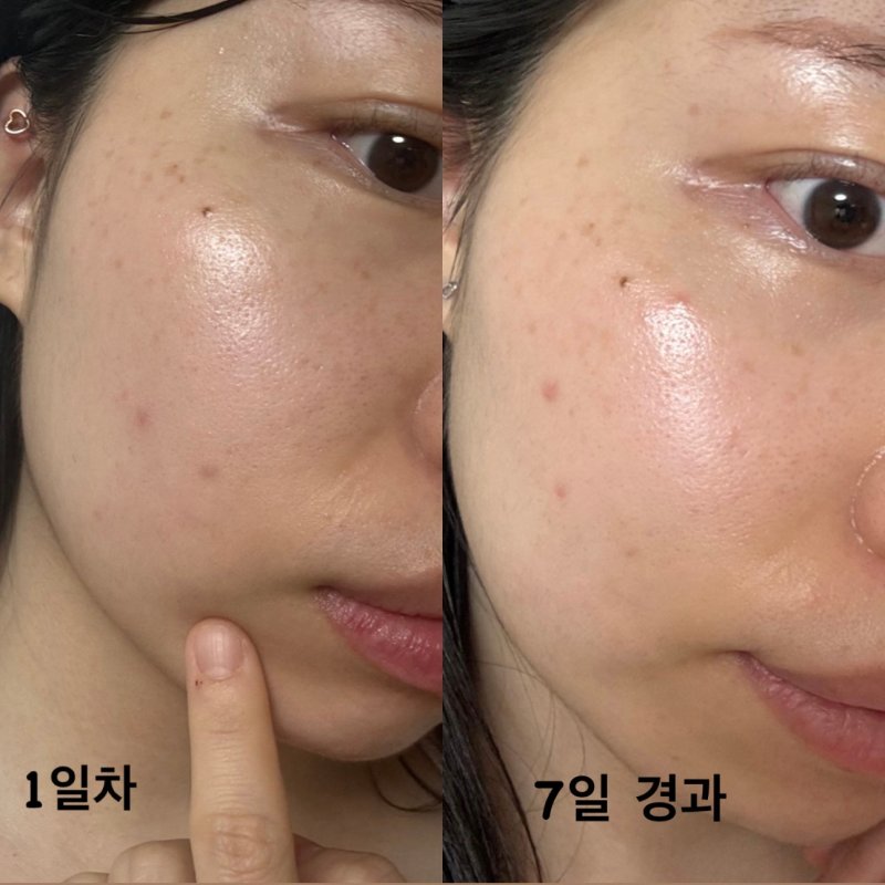 1+1|DERMAFIRM 💜 R4 藍甘菊外泌體水光精華