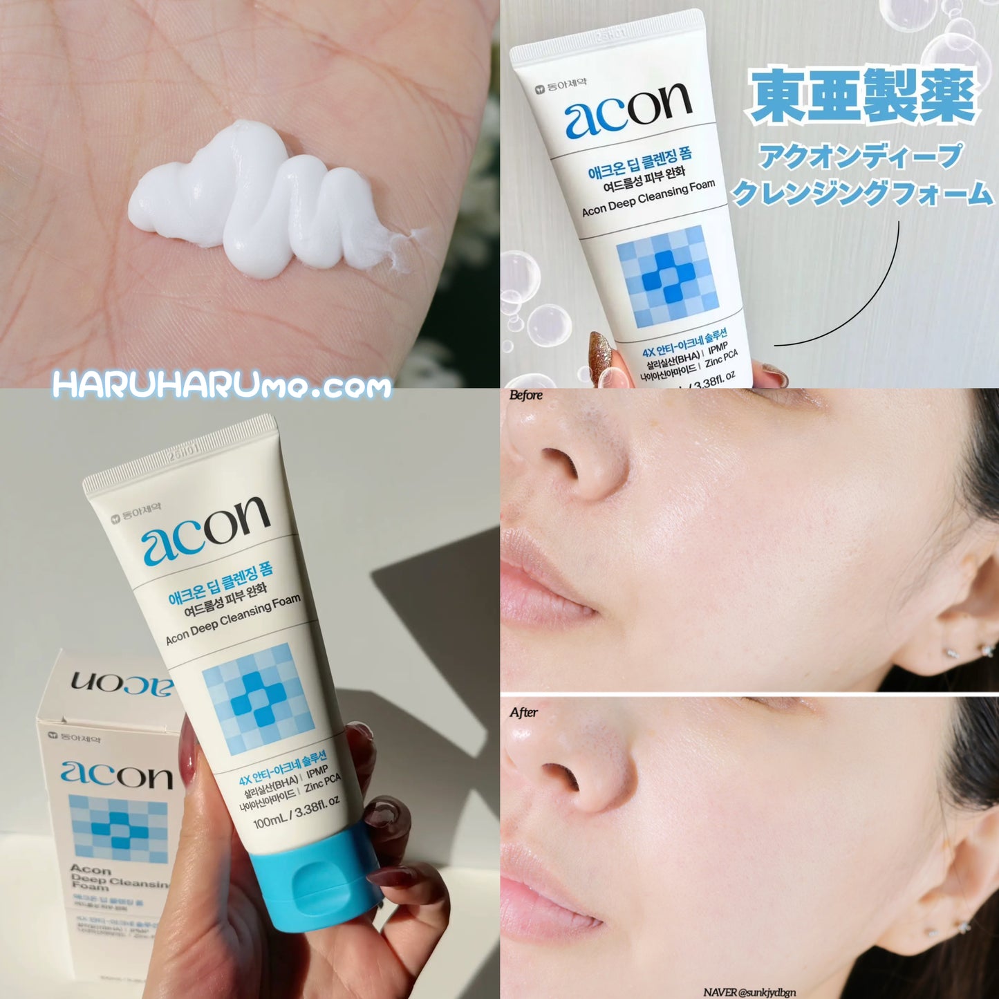 東亞製藥Acon 💙 水楊酸深層淨化抗痘潔面乳
