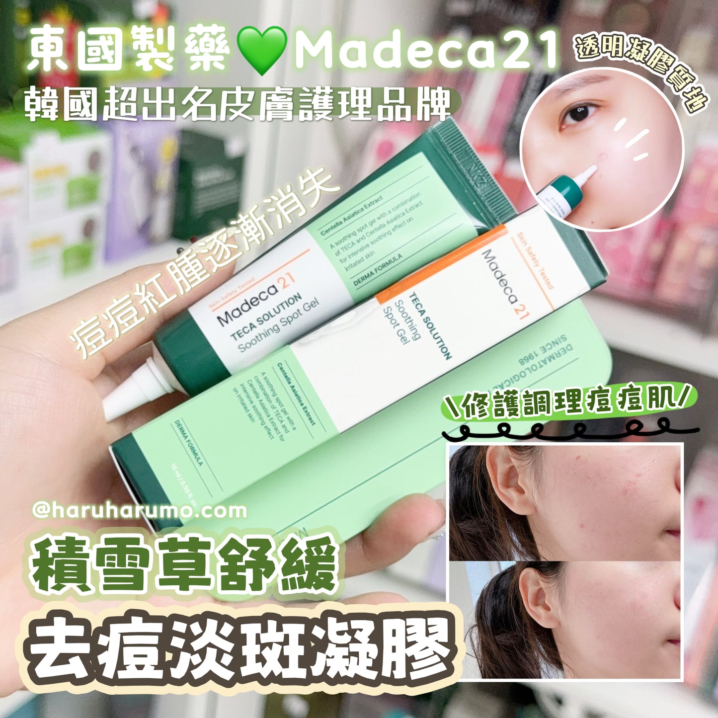 💚東國製藥Madeca21 💫積雪草舒緩去痘淡斑凝膠|長期熱賣缺貨