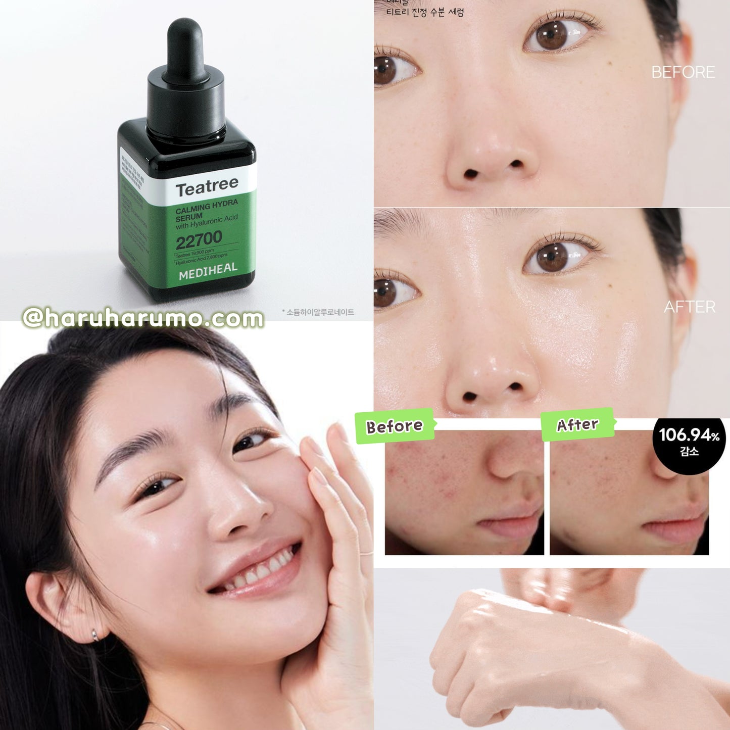 Mediheal 💚 茶樹消炎舒緩保濕精華✨