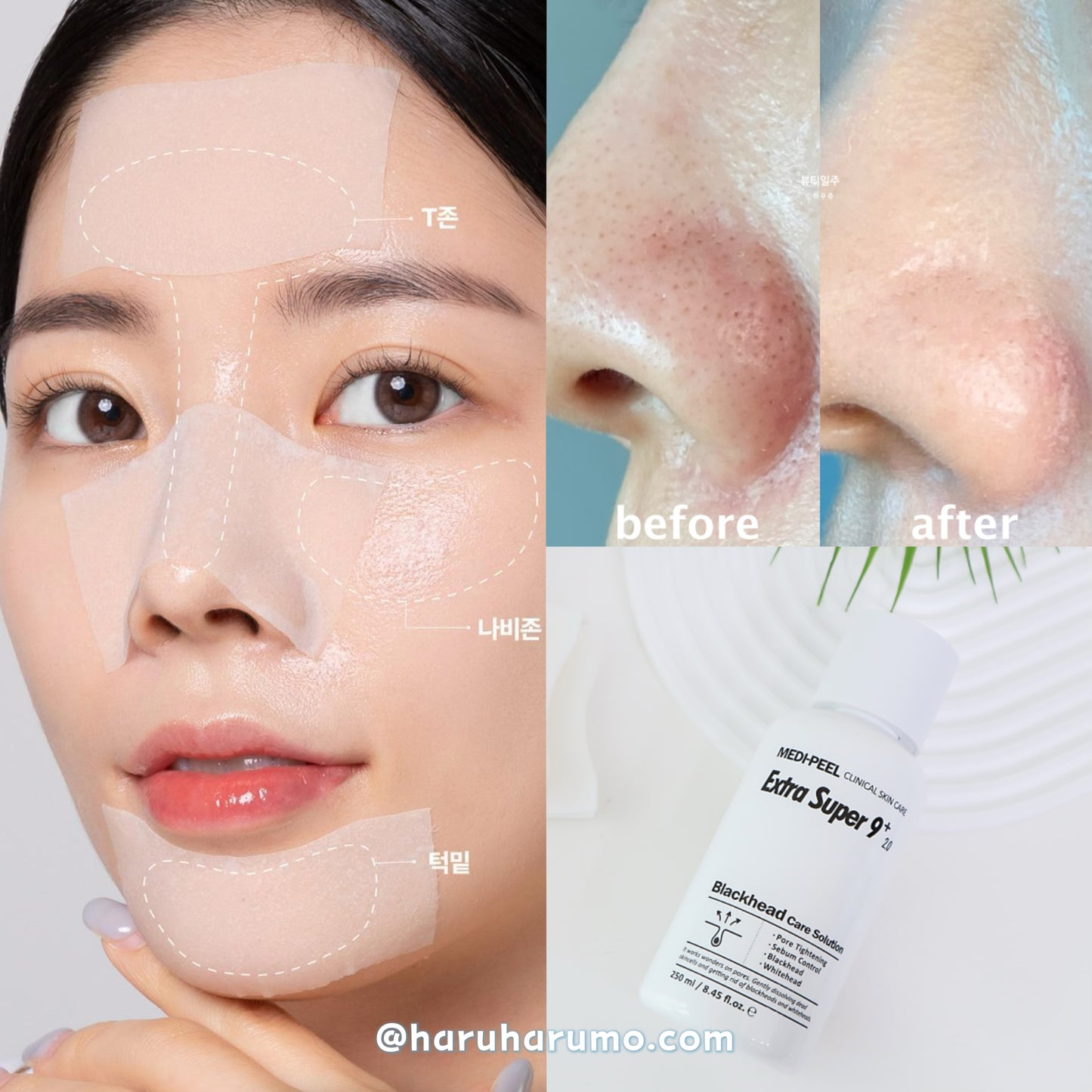 MediPeel Extra Super 9+ 💖 2.0 升級版黑頭導出液