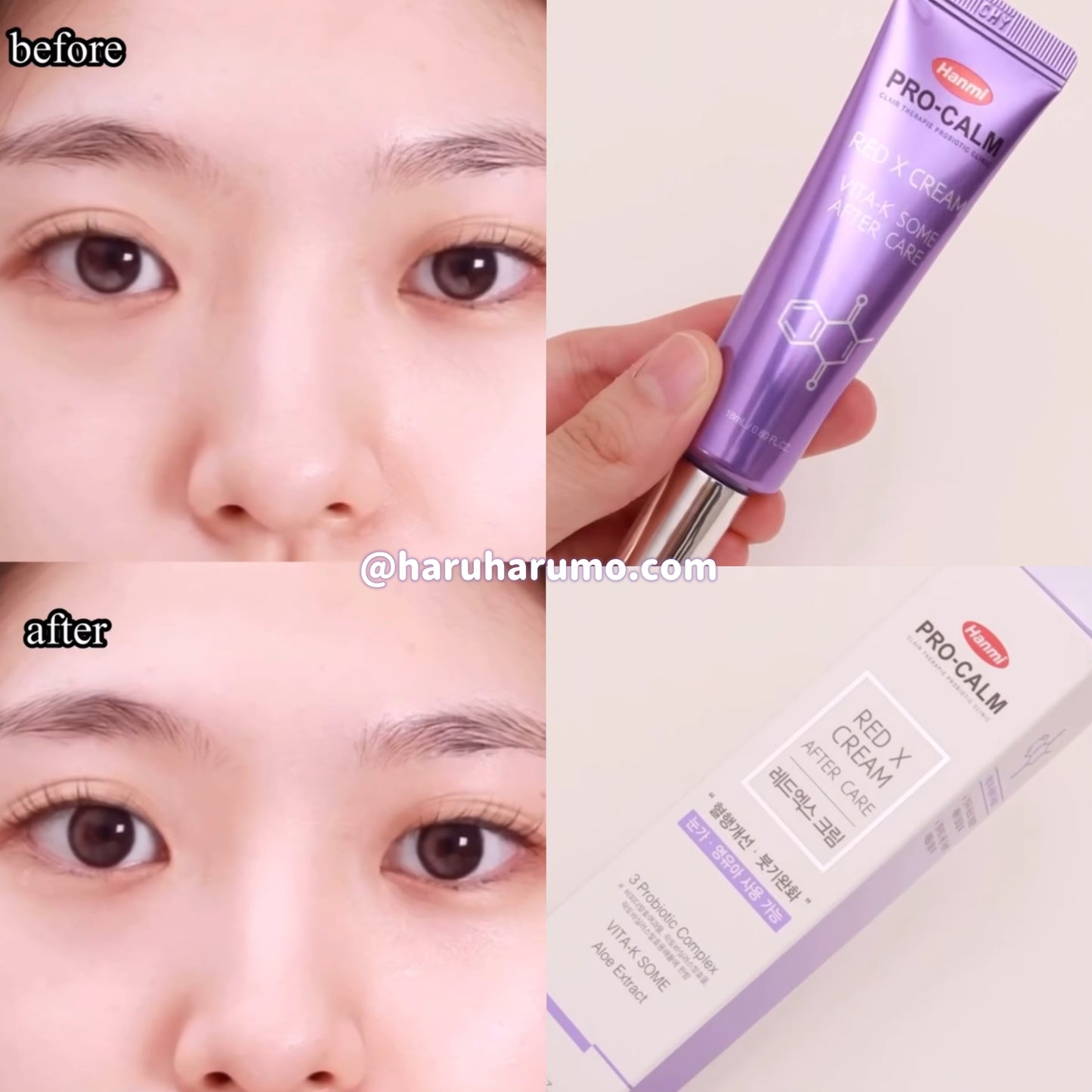 Hanmi 💜 維他命K黑眼圈修復霜 ✨Pro-Calm Red X Cream