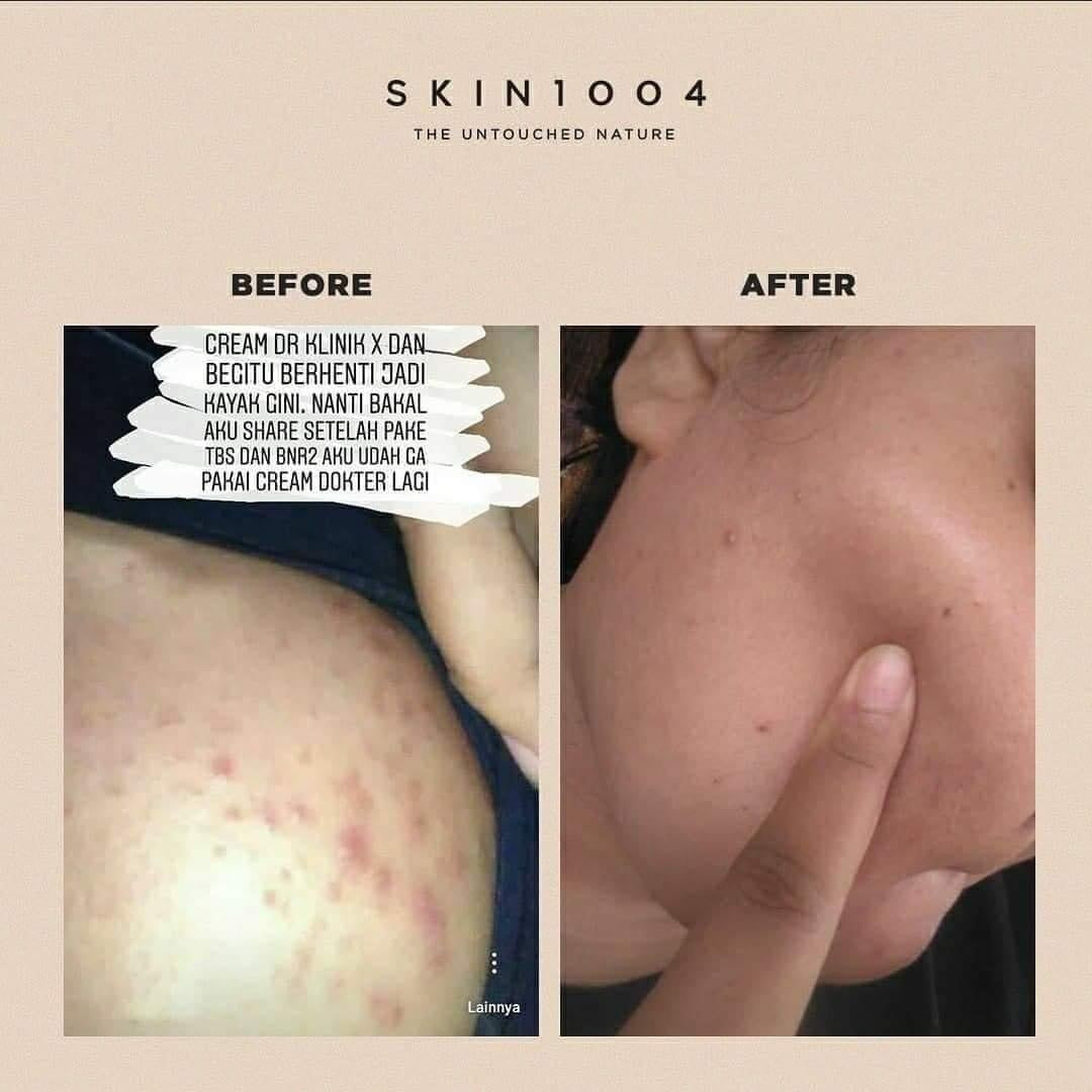 SKIN1004💚馬達加斯加積雪草舒敏精華液 100ml