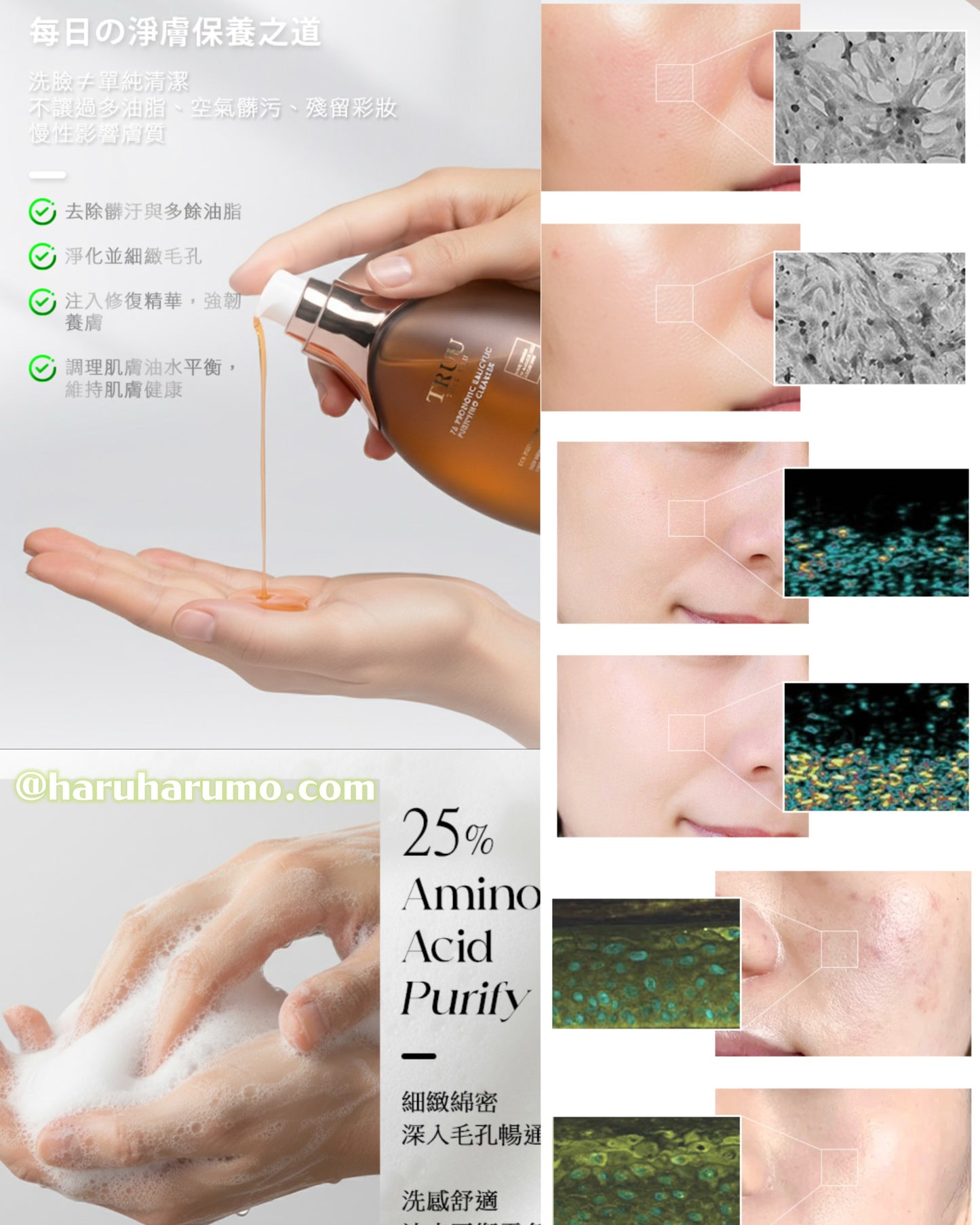 新品🌟油肌救星|TRUU ✨ 76水楊酸酵母淨膚潔顏露🌟
