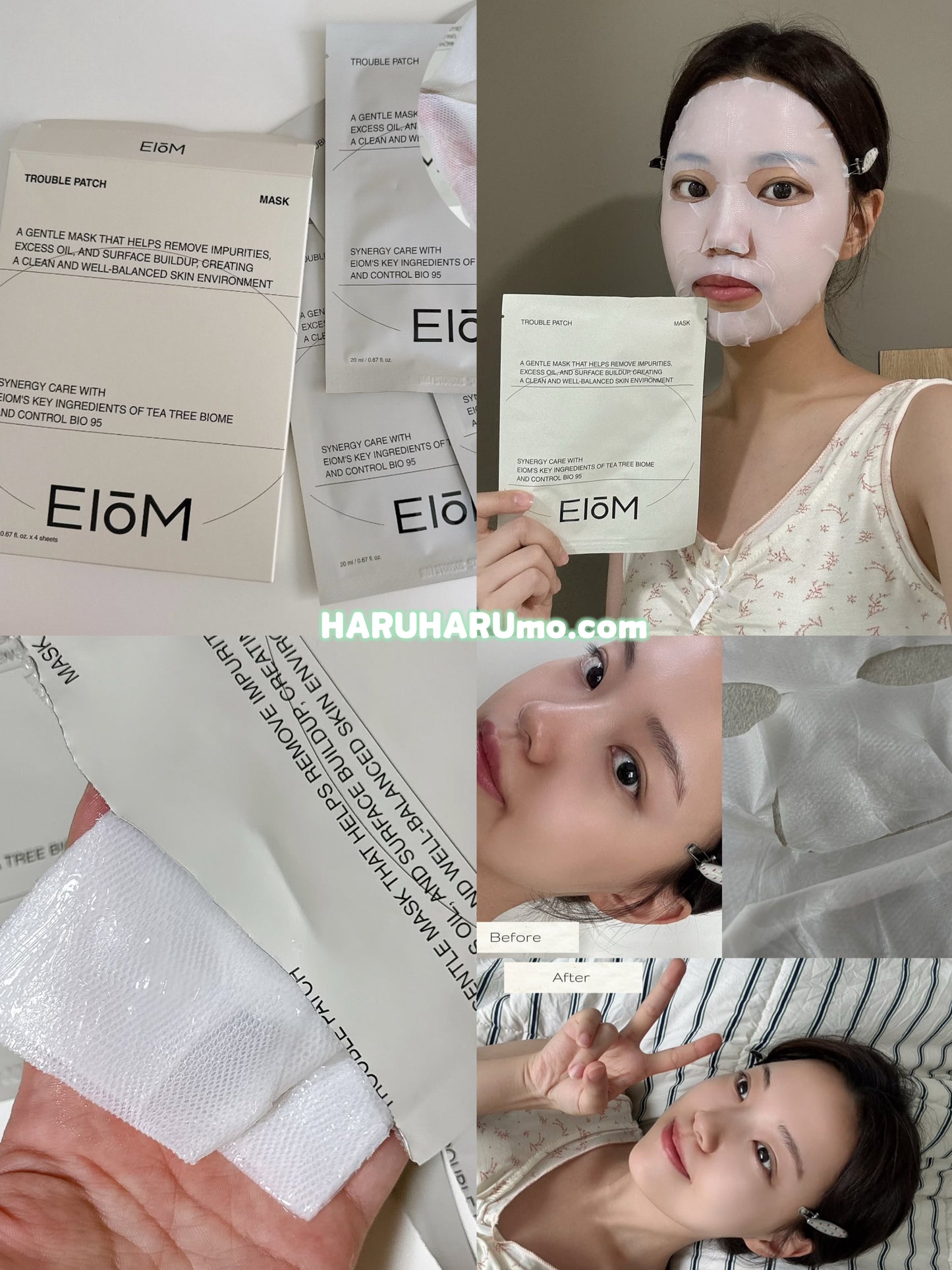 🇰🇷 EIOM 💚 祛痘淨膚面膜 ✨