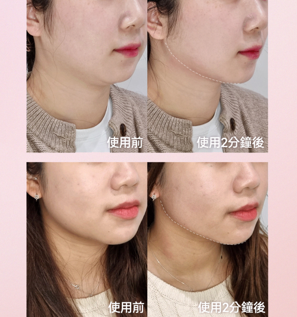 Milktouch 💗 多功能瘦面去水腫排毒陶瓷刮痧器✨