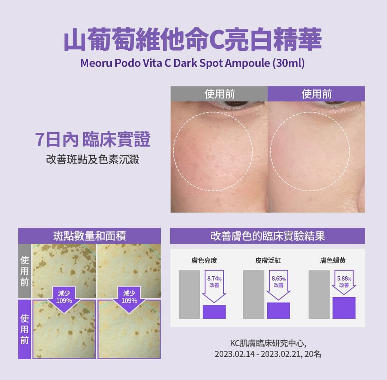 【7日美白透亮】Sungboon Editor🍇山葡萄維他命C亮白精華✨