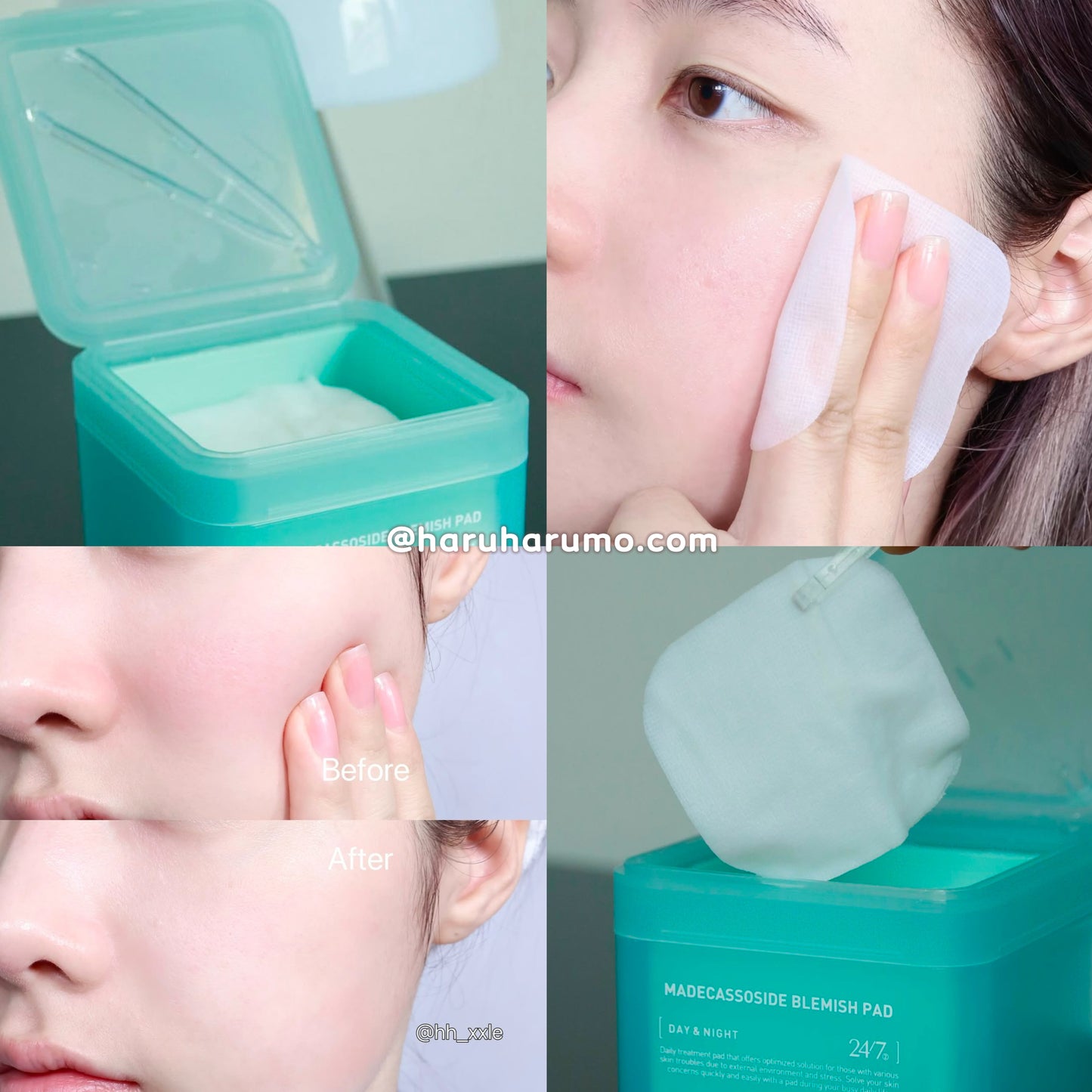 100+100+14片!|Mediheal 積雪草舒緩去敏零瑕疵棉片💫 OY第1名