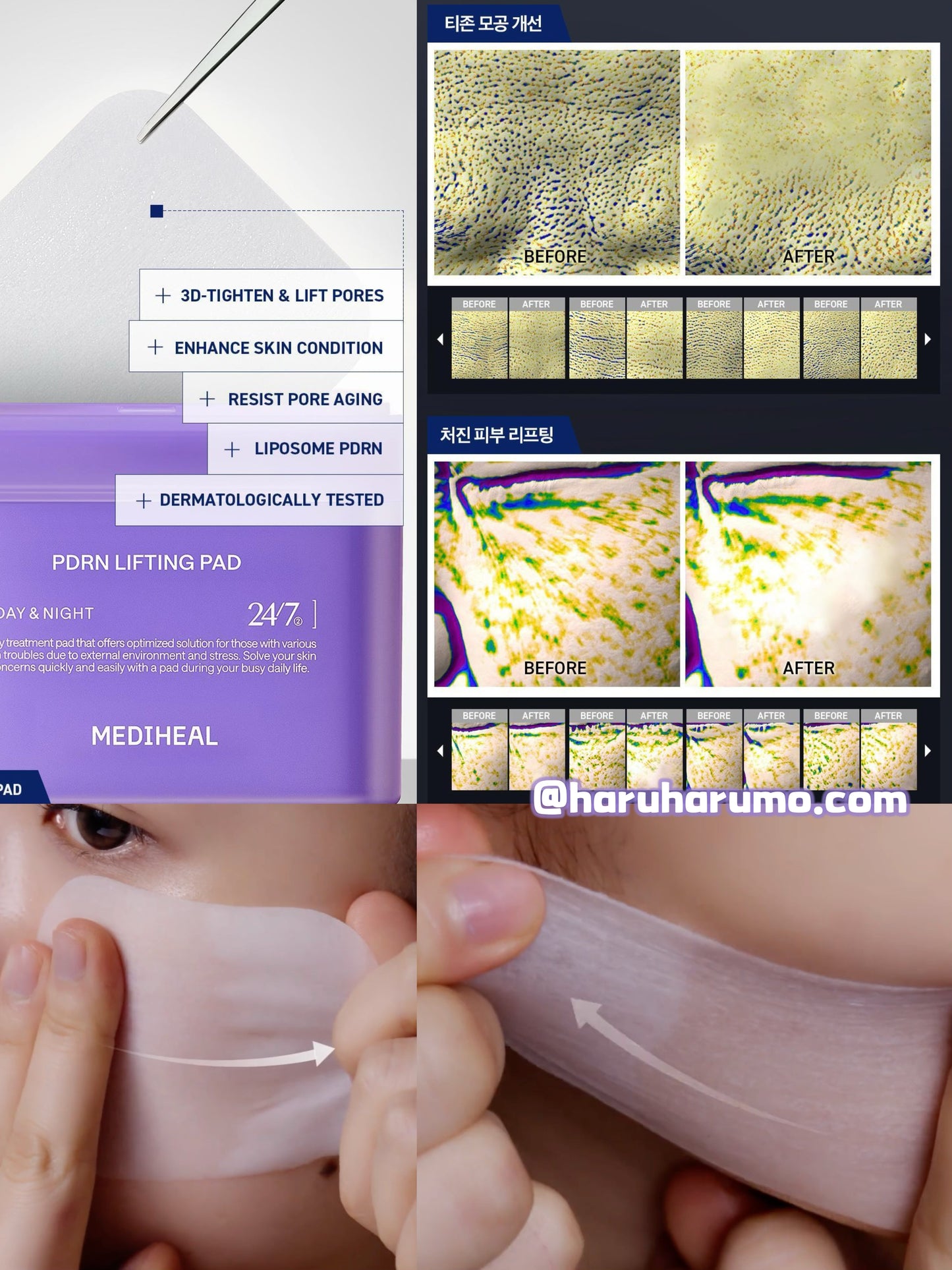 MEDIHEAL 💜 PDRN毛孔彈力柔膚棉✨