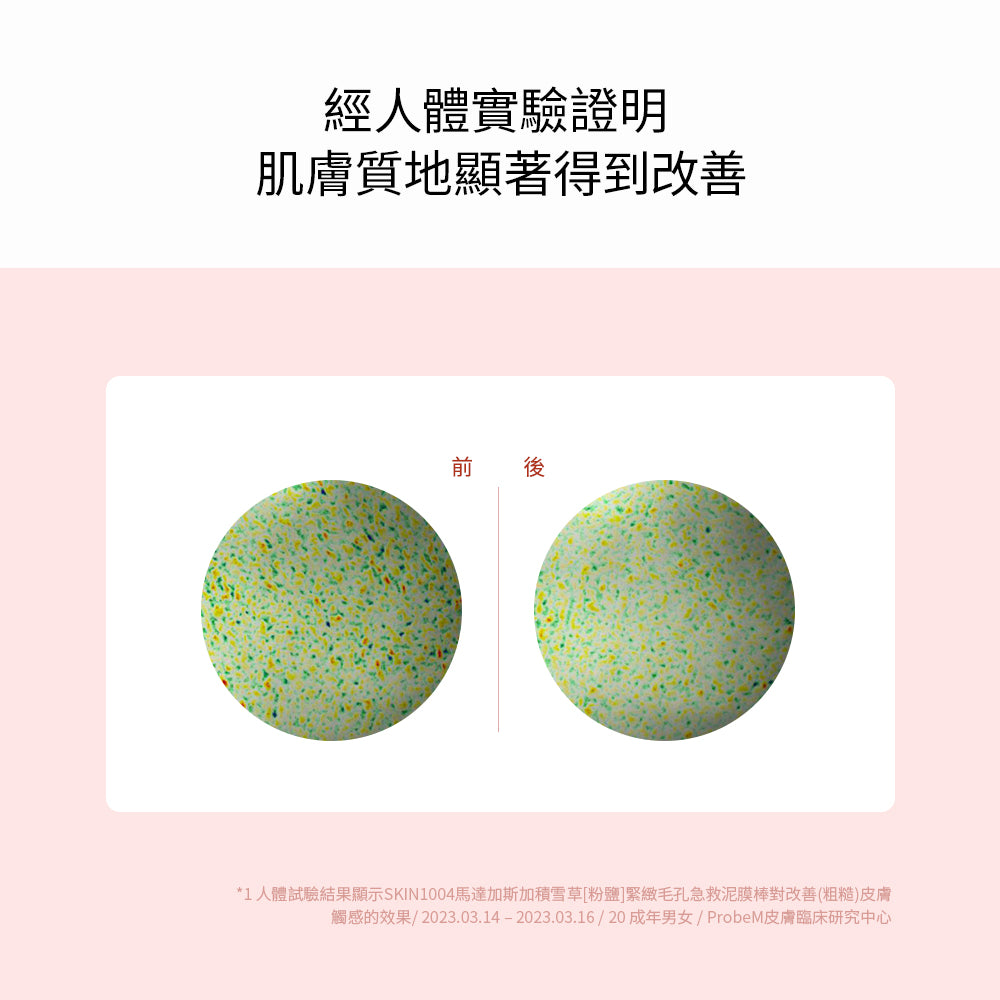 SKIN1004 💗 積雪草粉鹽緊緻毛孔泥棒面膜