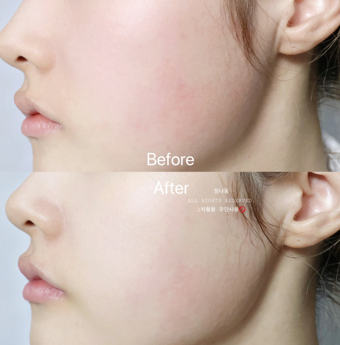 Abib 💚 Green Pore Pad 清爽去暗粒棉片
