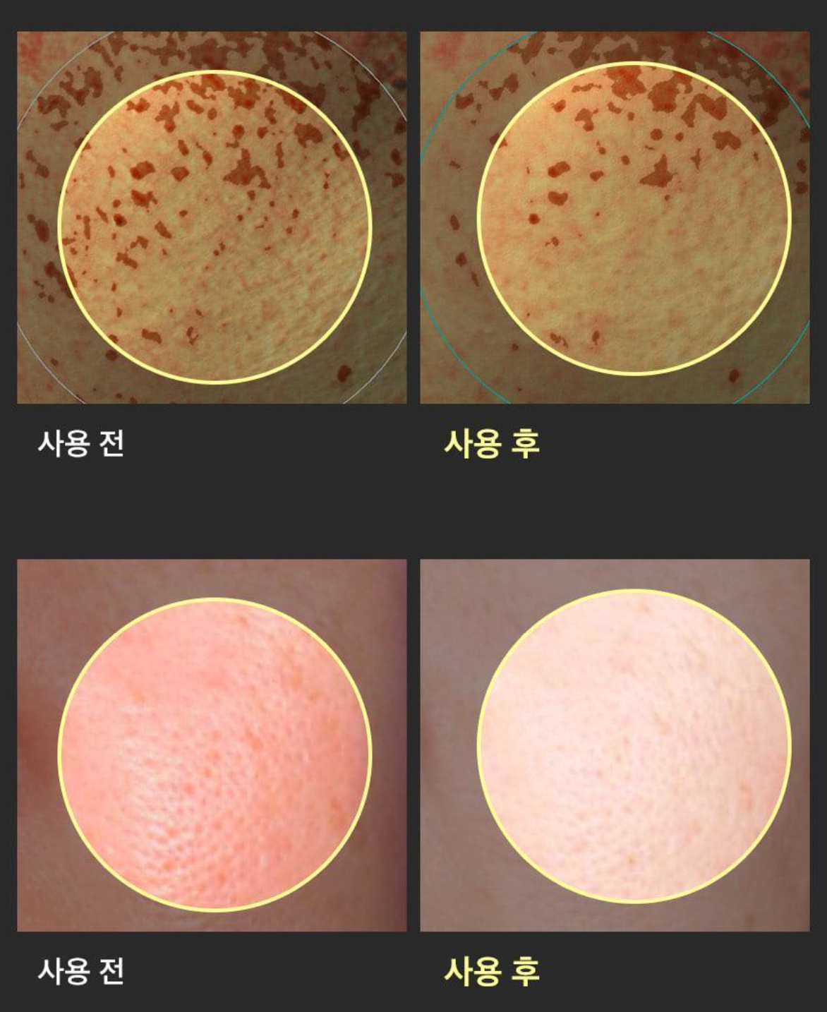 1+1 新升級✨Sungboon Editor 🍇山葡萄維他命C亮白精華✨