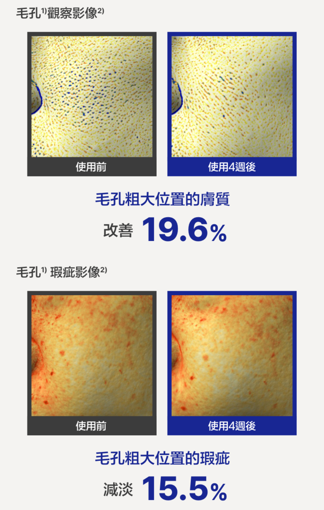 25ml+20ml套裝｜innisfree ❄️ PDRN水光亮肌精華