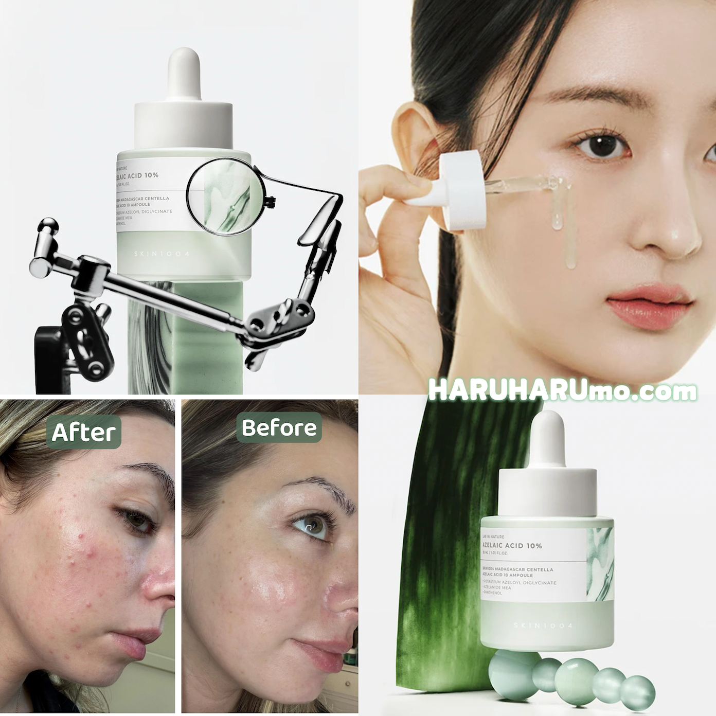 新上市｜SKIN1004 Lab in Nature💚10%壬二酸+積雪草 控油去痘舒緩精華✨