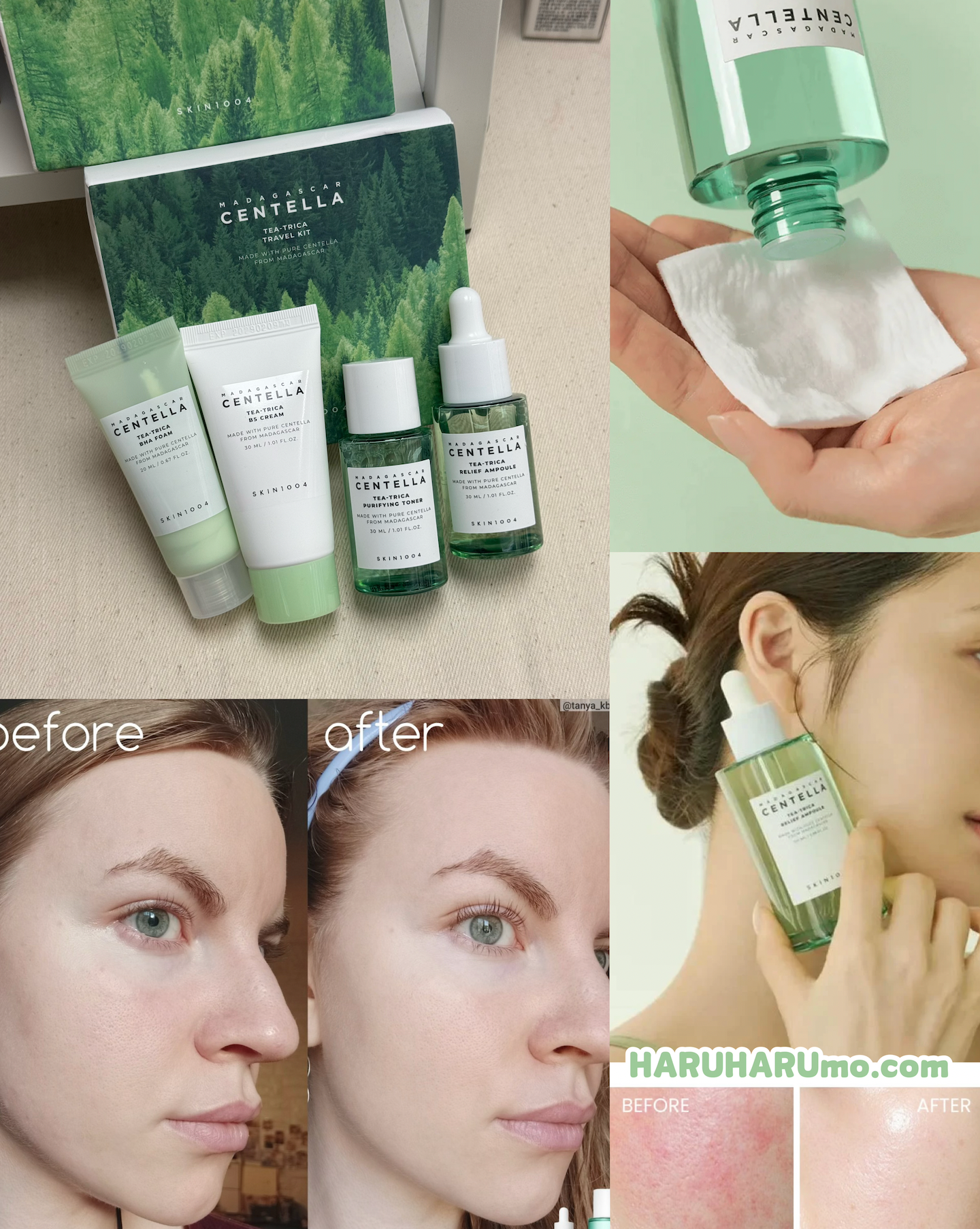 SKIN1004 馬達加斯加積雪草💚茶樹舒緩旅行套裝✨