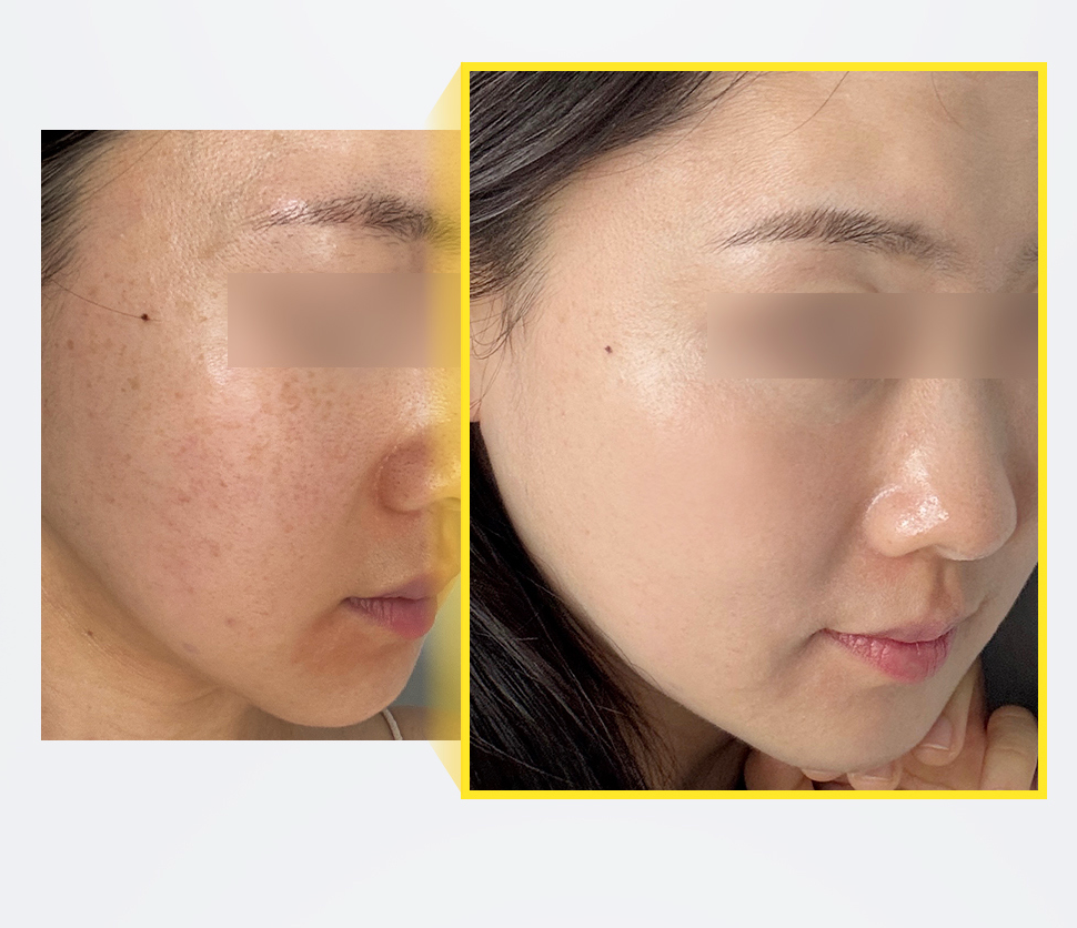 mommy care 🍊Orthotamin 15%高純維C淡斑乳霜