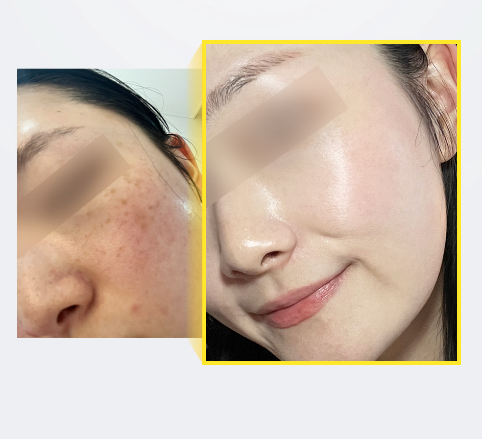 mommy care 🍊Orthotamin 15%高純維C淡斑乳霜