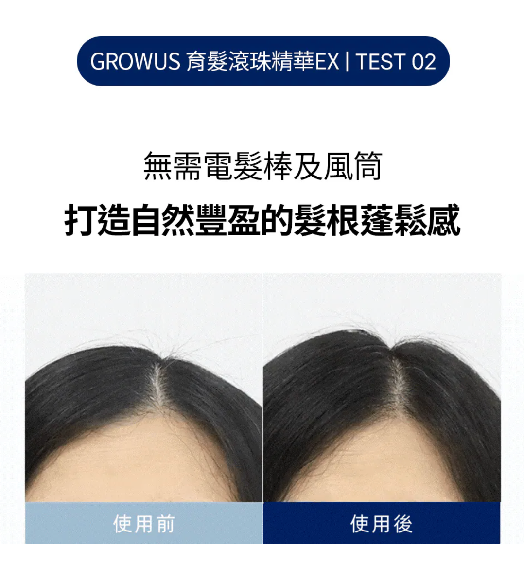 激活髮根｜GROWUS 🧬 育髮滾珠精華EX✨