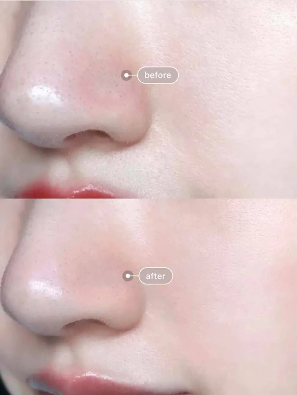 Medicube💙  ZERO毛孔爽膚棉2.0✨零毛孔美肌