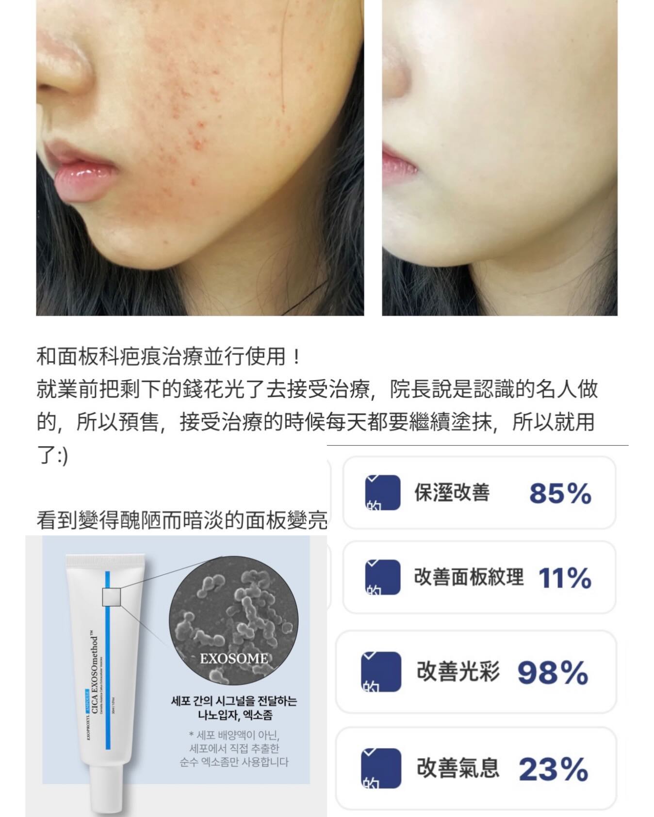 ✨EXOPROXYL 🧬CICA EXOSOmethod PLUS 積雪草外泌體50安瓶乳霜