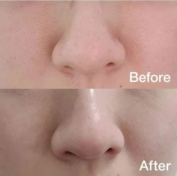 Medicube💙  ZERO毛孔爽膚棉2.0✨零毛孔美肌