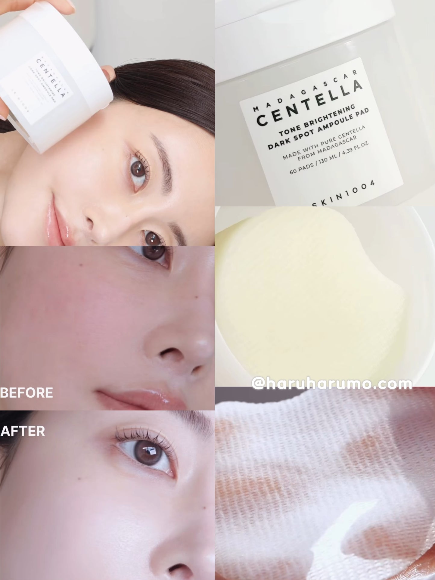 SKIN1004 🤍 馬達加斯加積雪草提亮美白淡斑安瓶棉片 ✨