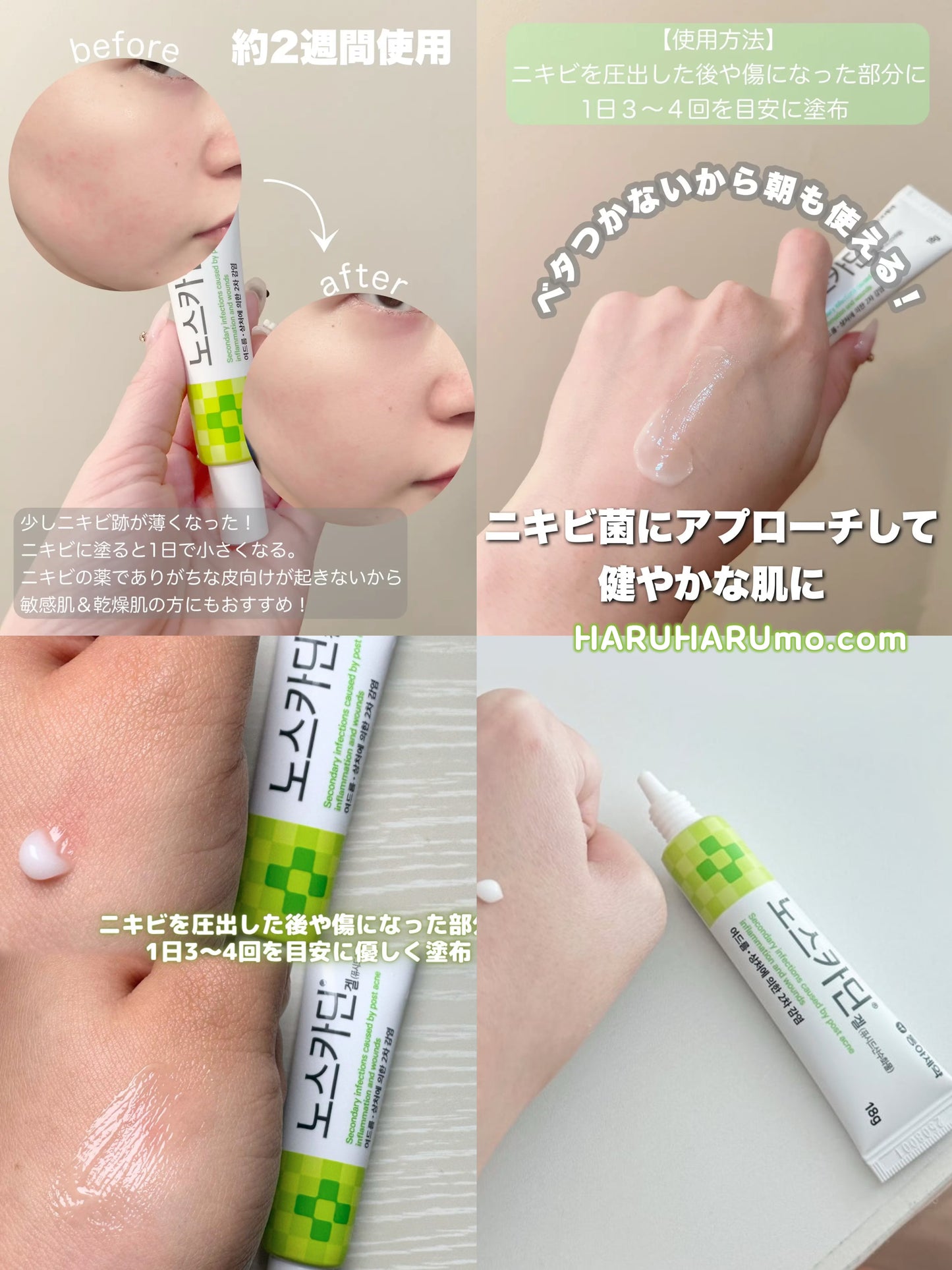 Noscardin 針清小綠管｜東亞製藥💚抗痘修護消炎膏