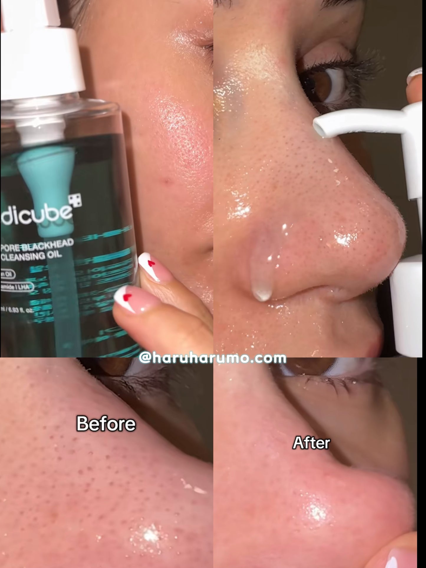 Medicube 💙Zero Pore 黑頭毛孔深層卸妝油✨