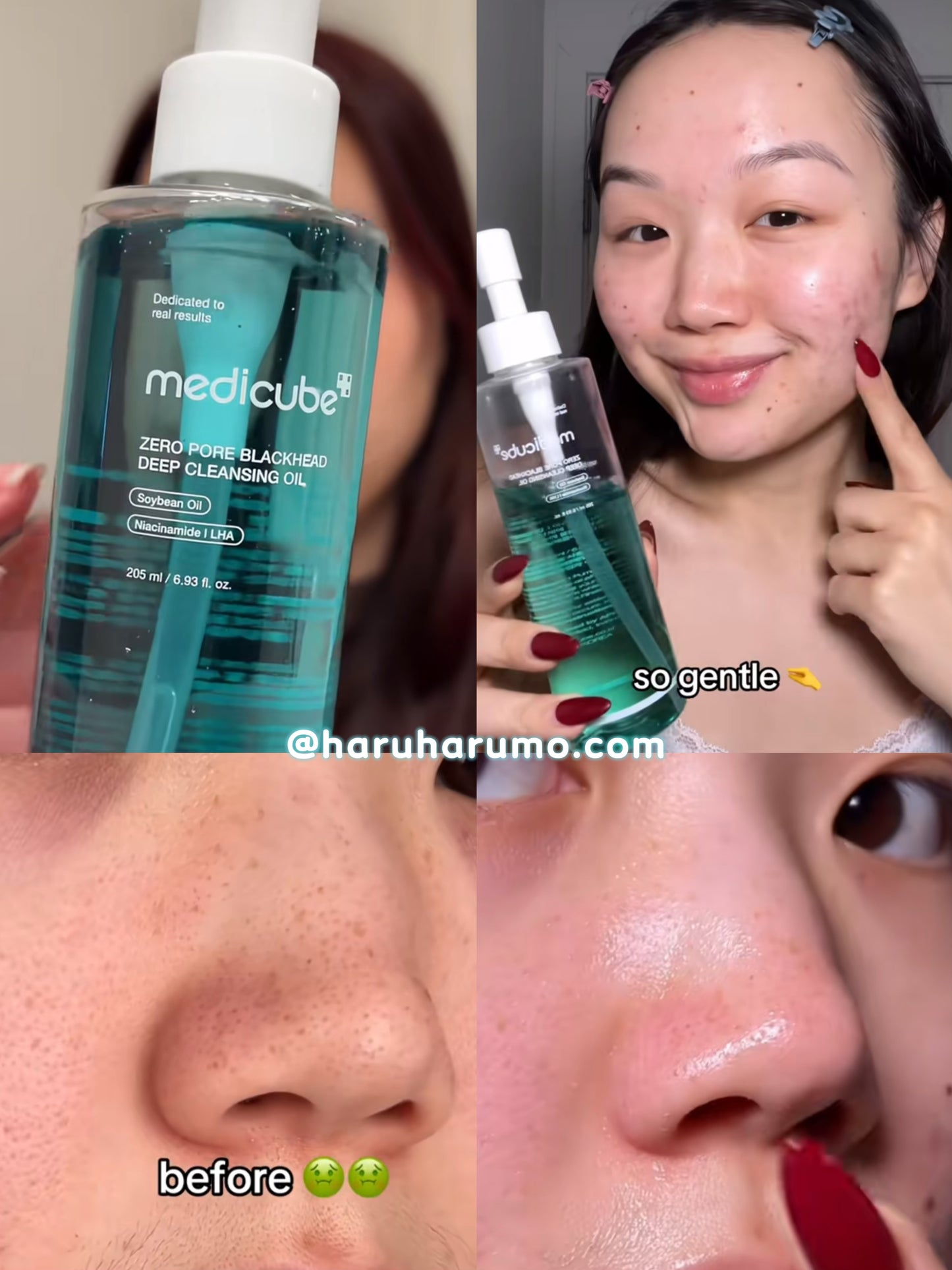 Medicube 💙Zero Pore 黑頭毛孔深層卸妝油✨