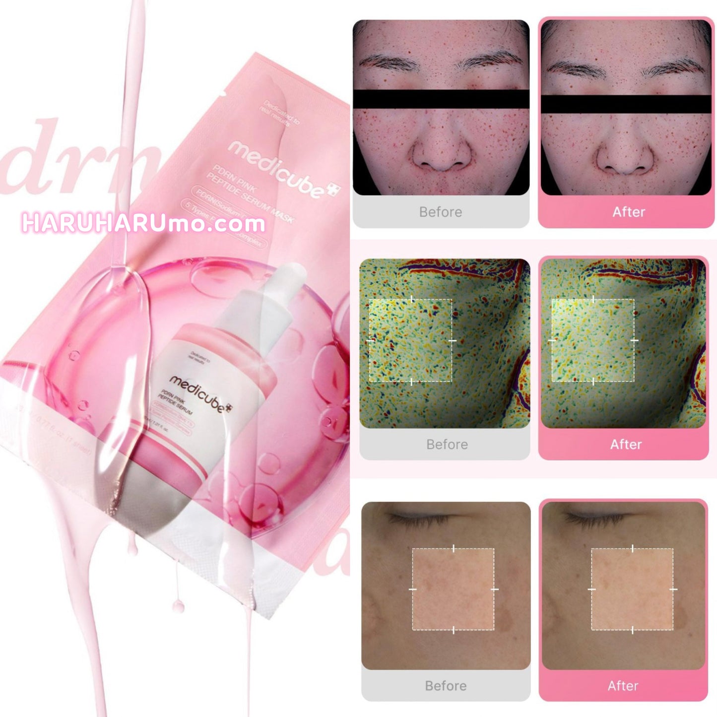 Medicube 💗 PDRN粉紅胜肽膠原安瓶面膜
