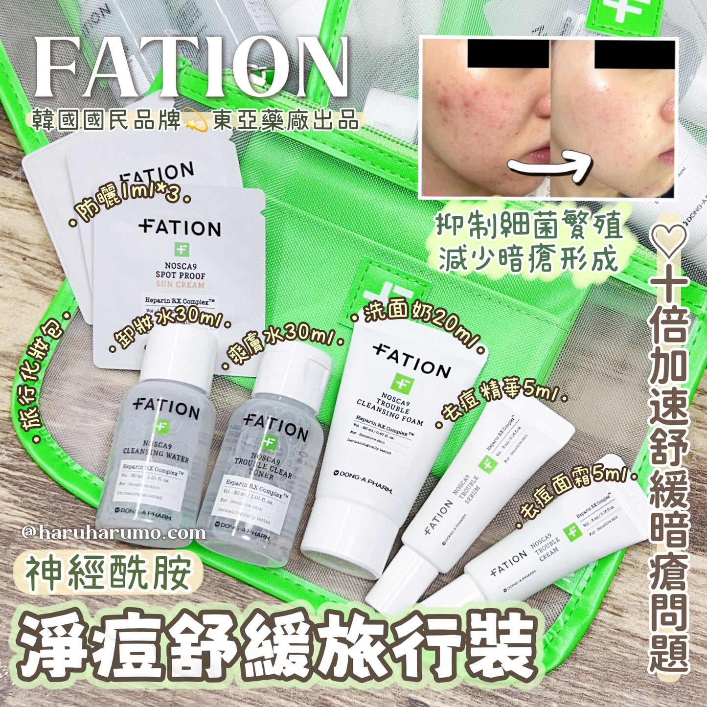 Fation 💚 神經酰胺淨痘舒緩旅行套裝✨