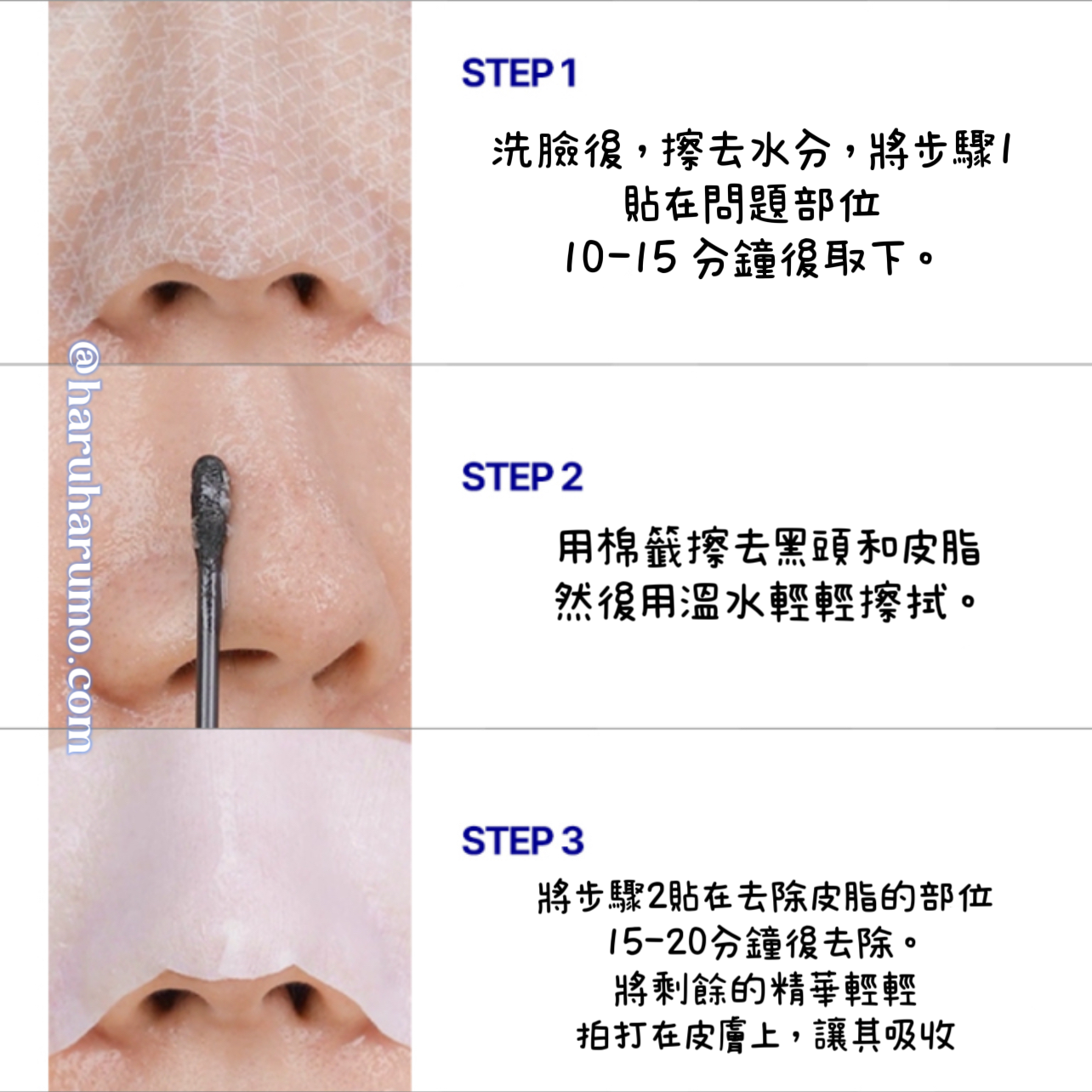 Medipeel 💙 去黑頭粉刺鼻貼✨