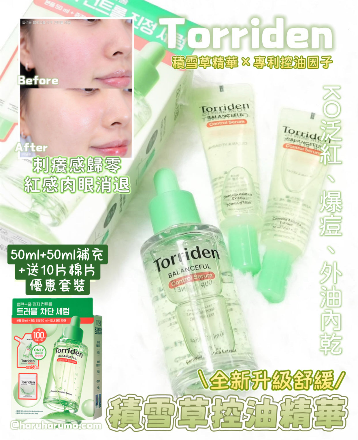 50+50ml+送10片棉片｜Torriden🌿平衡舒緩積雪草控油精華✨