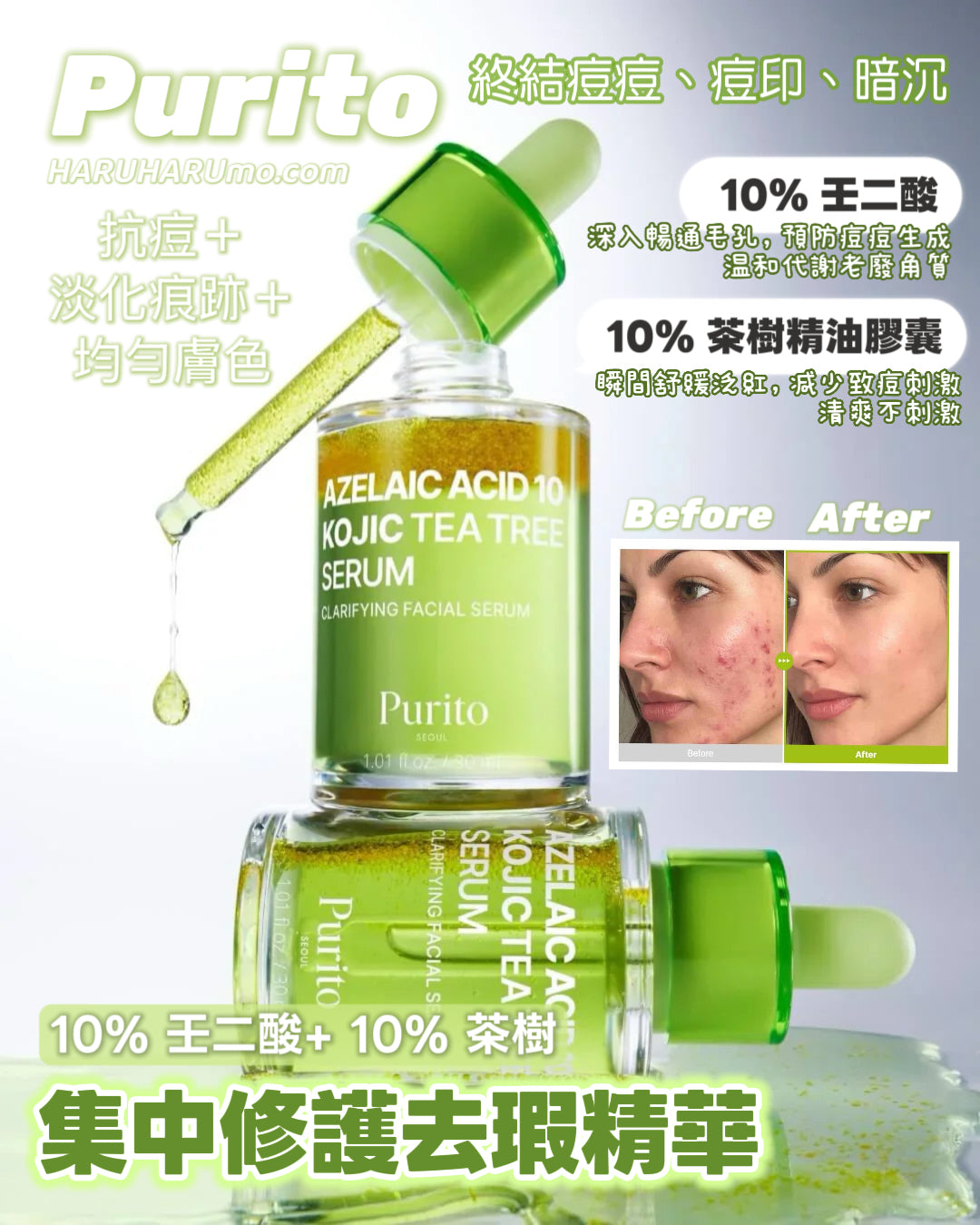 Purito 🌿 SEOUL 10% 壬二酸+ 10% 茶樹｜集中修護精華✨
