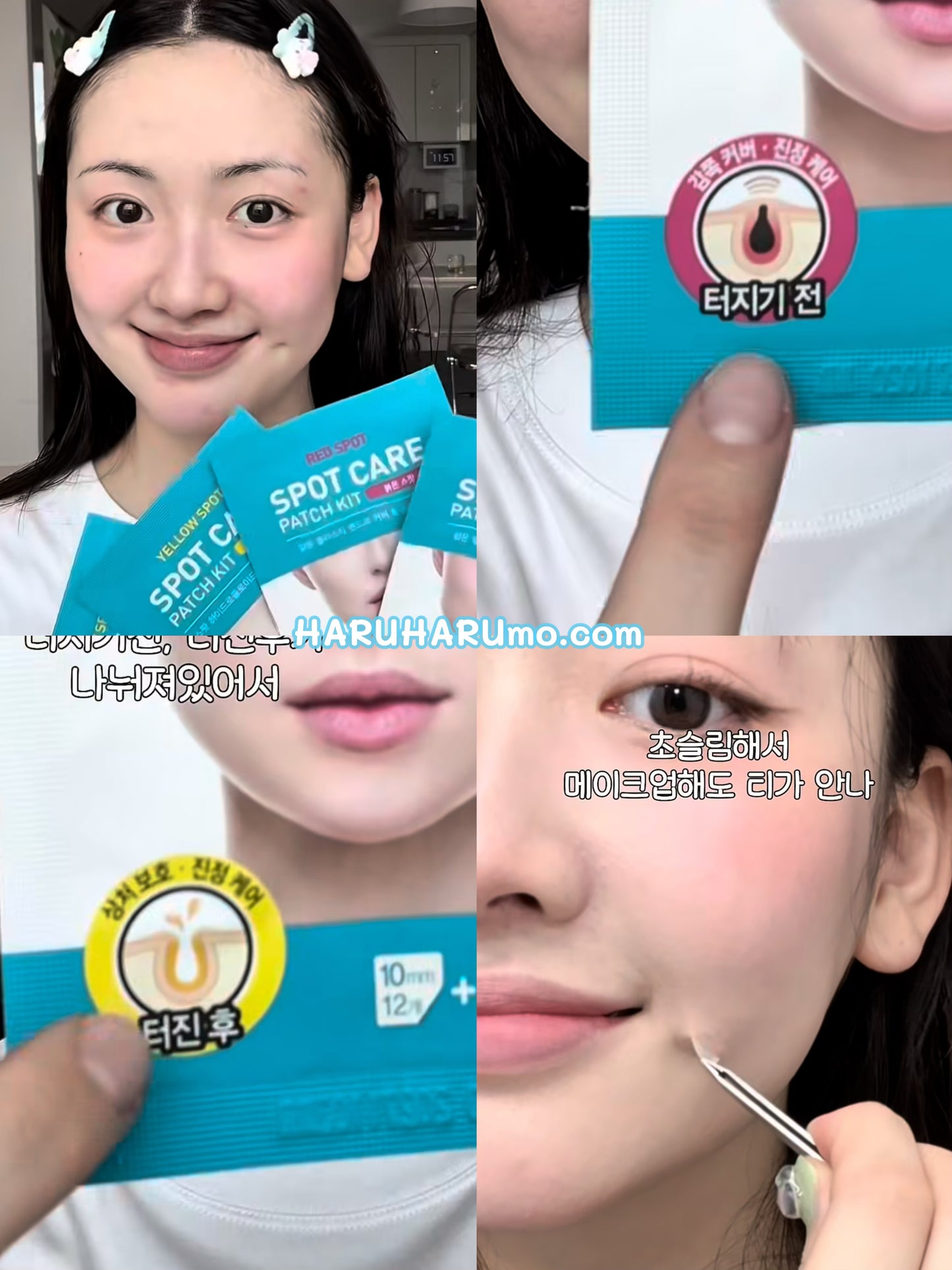 HATHERINE ⭐️ 階段式分區痘痘貼🚑