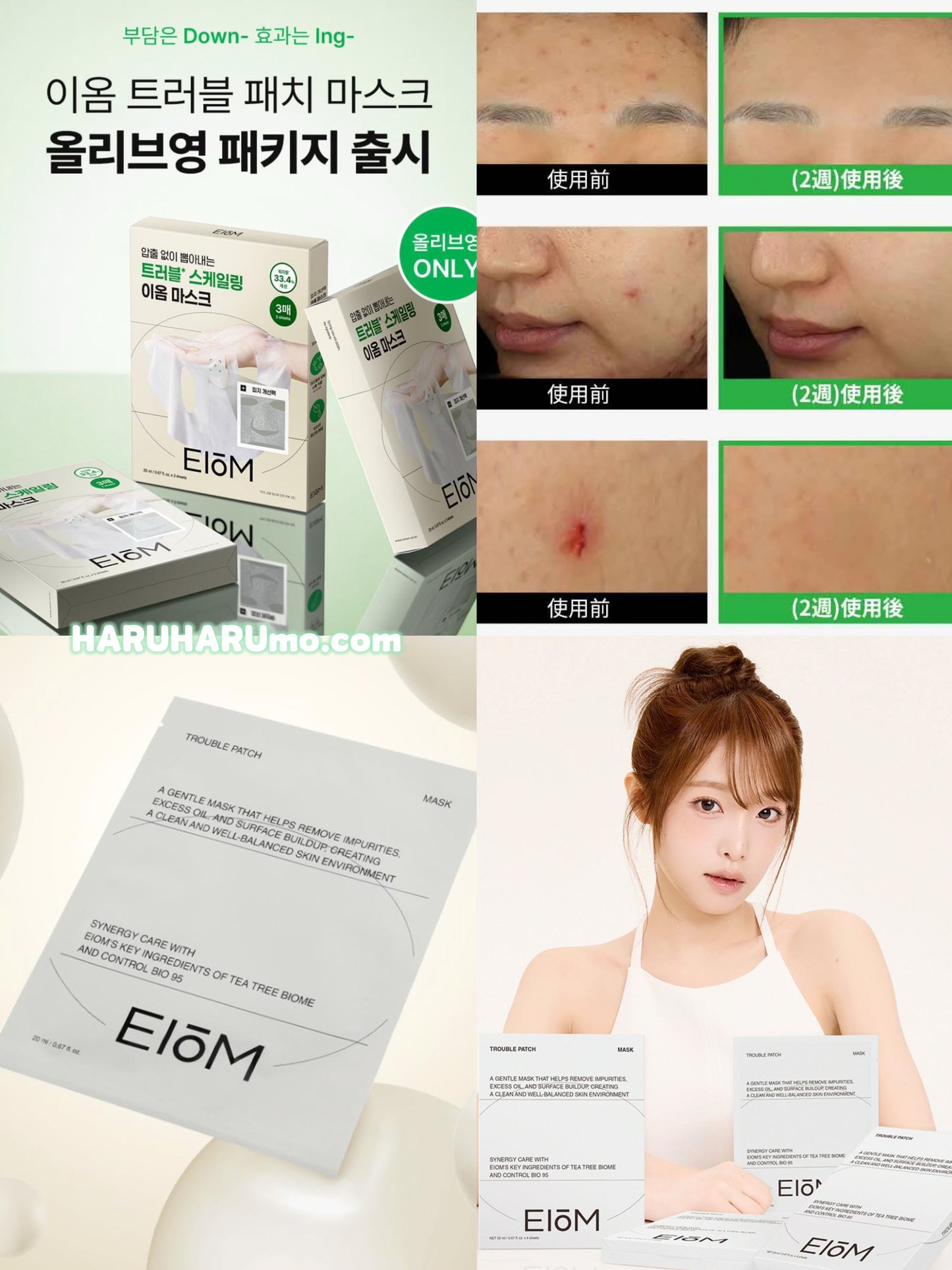 🇰🇷 EIOM 💚 祛痘淨膚面膜 ✨