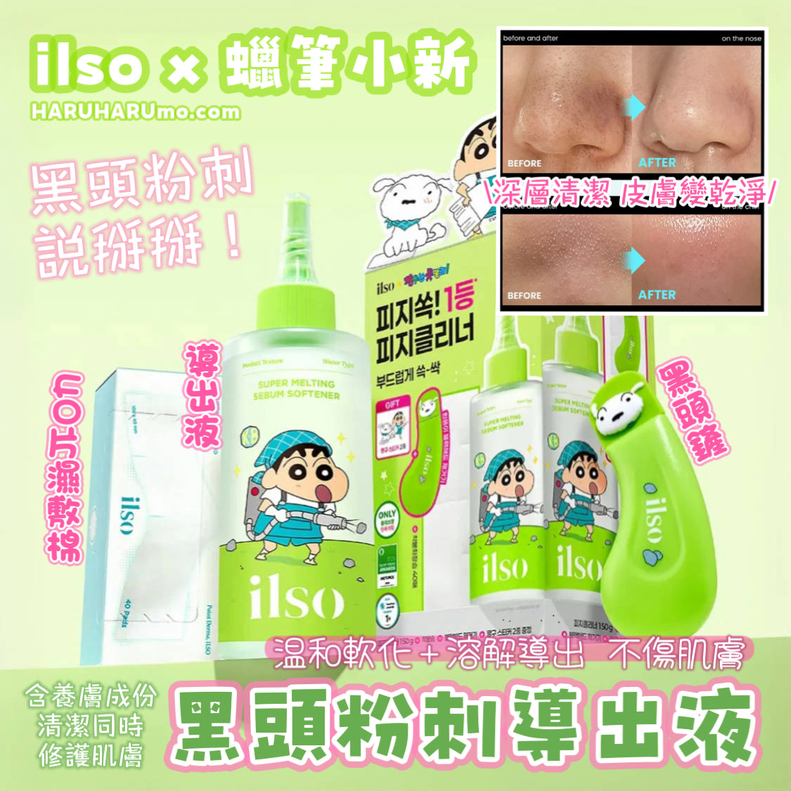 送黑頭鏟+濕敷棉｜ ilso x 蠟筆小新💚 黑頭粉刺導出液 ☁️