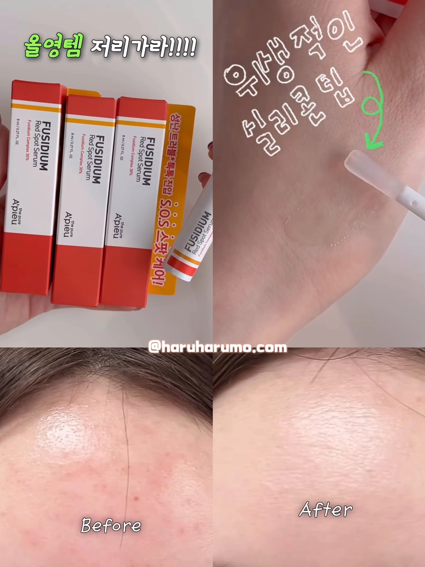apieu 🚑 最新升級✨痘痘急救精華