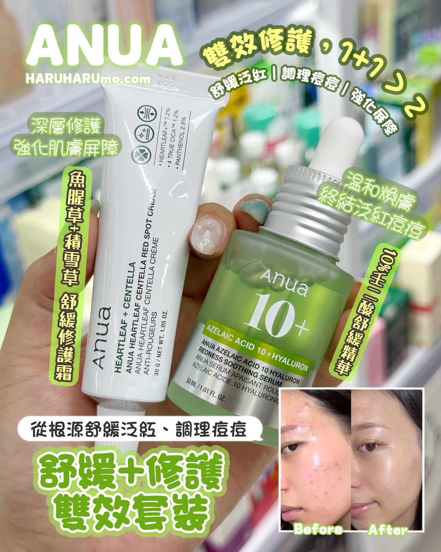ANUA 💚✨舒緩修護雙效套裝💫