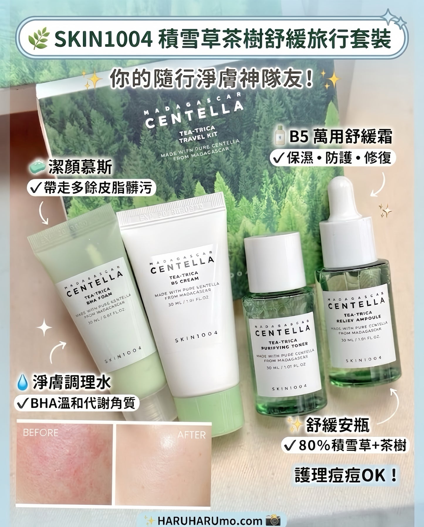 SKIN1004 馬達加斯加積雪草💚茶樹舒緩旅行套裝✨