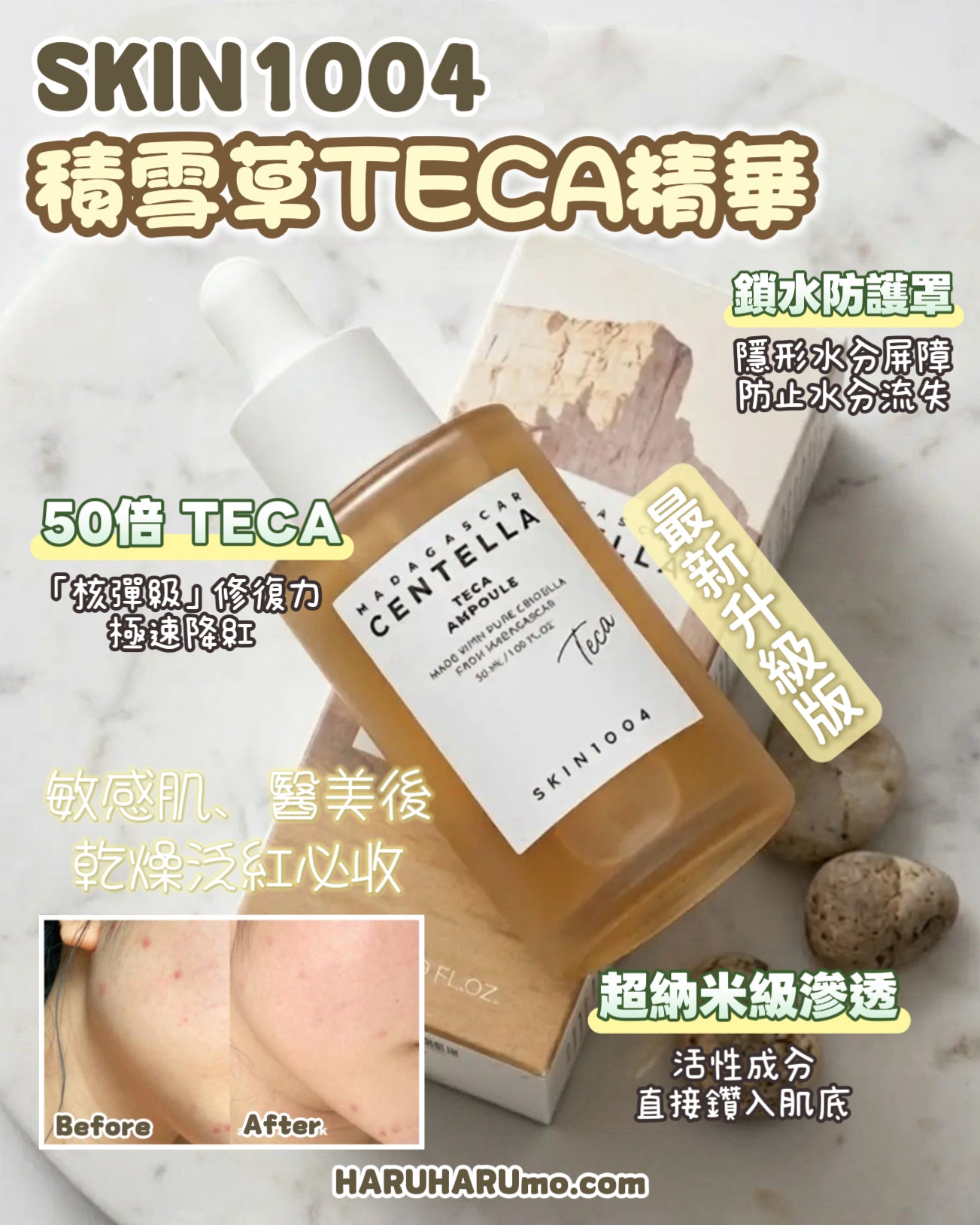 泛紅乾燥急救｜SKIN1004 ⭐️馬達加斯加積雪草TECA精華