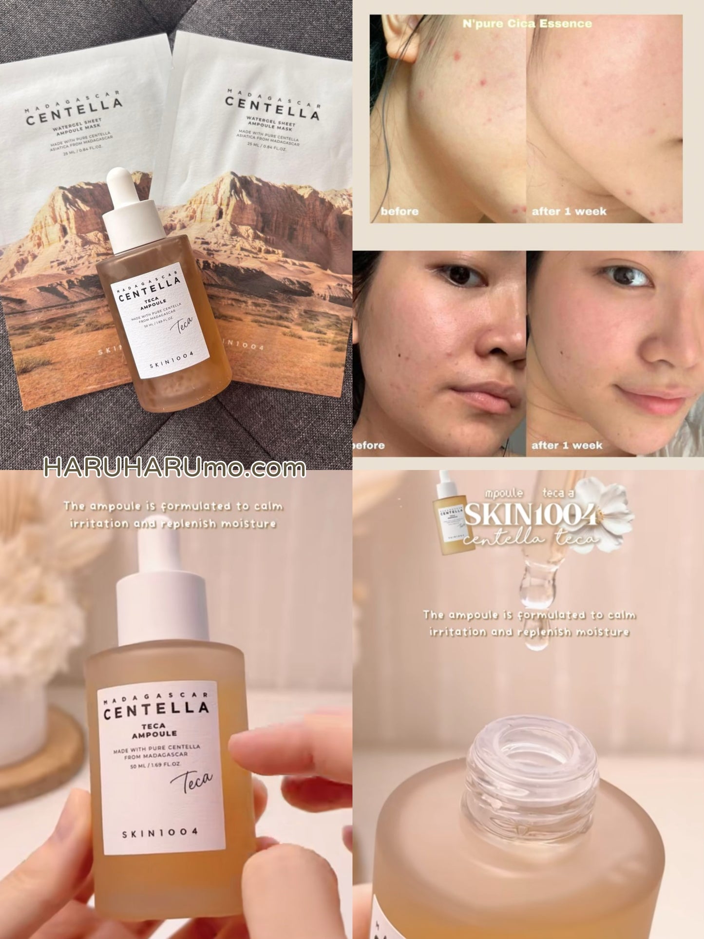 泛紅乾燥急救｜SKIN1004 ⭐️馬達加斯加積雪草TECA精華