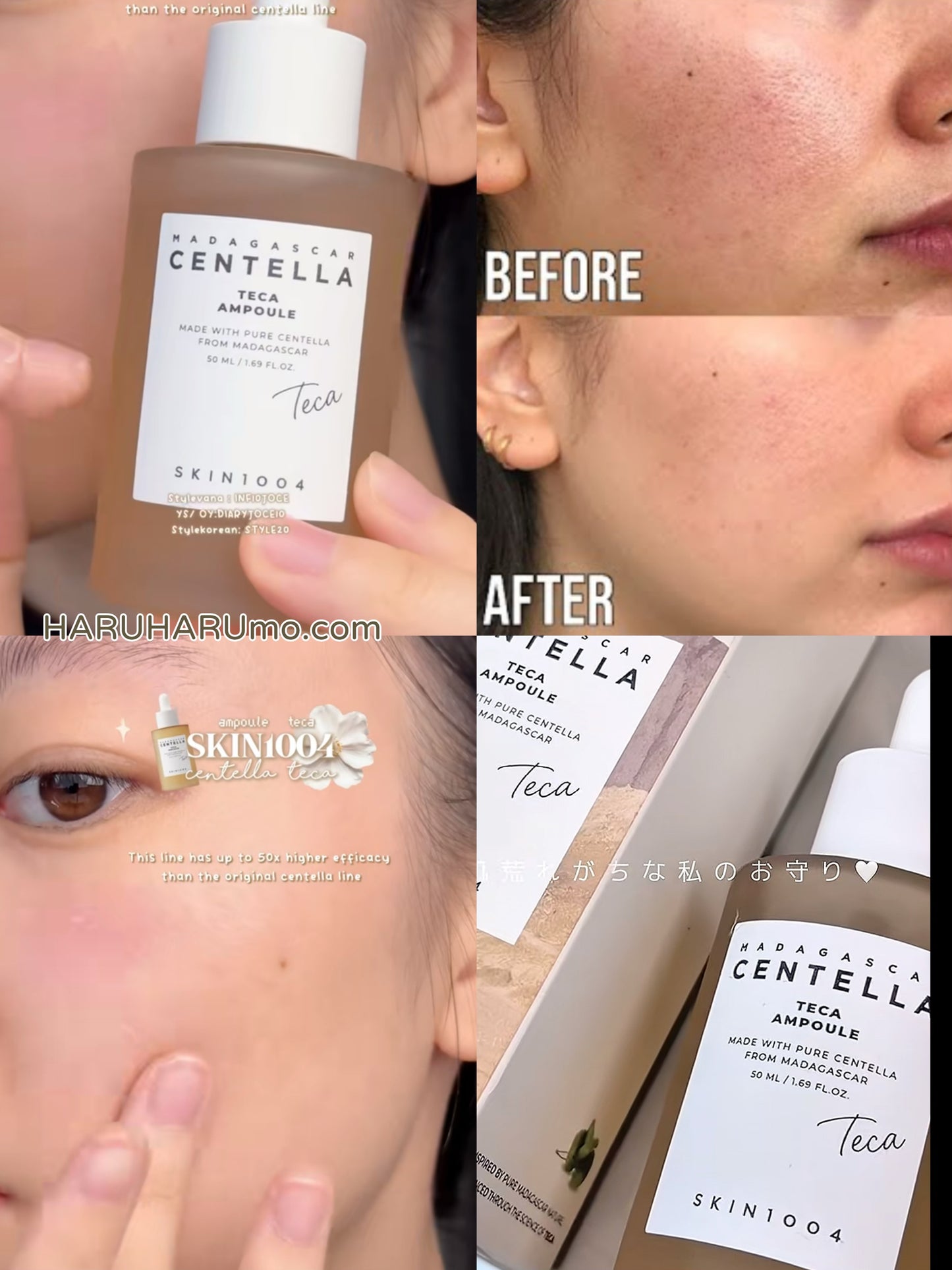 泛紅乾燥急救｜SKIN1004 ⭐️馬達加斯加積雪草TECA精華