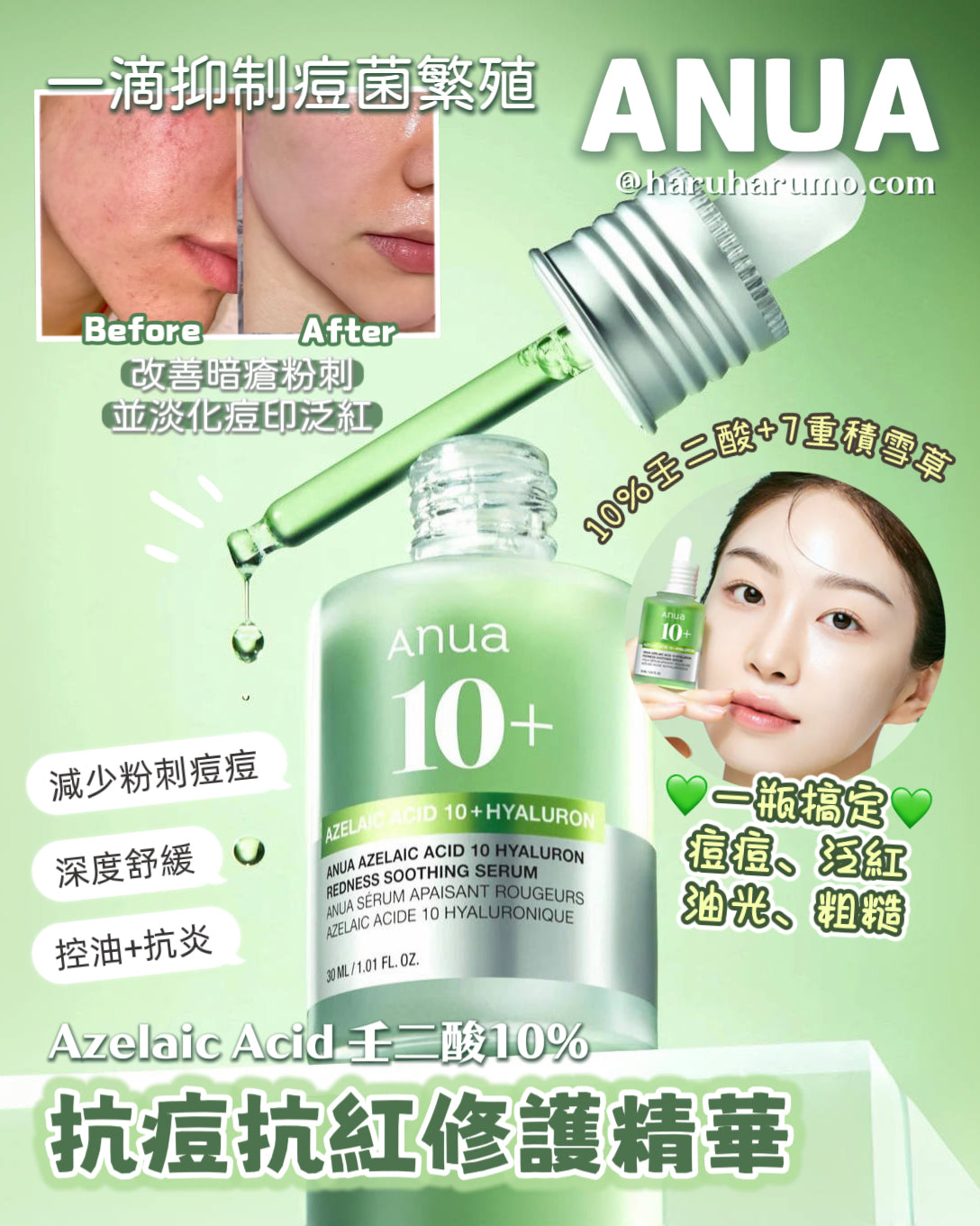 專為敏弱痘肌｜ ANUA 🌿Azelaic壬二酸10%抗痘抗紅修護精華✨